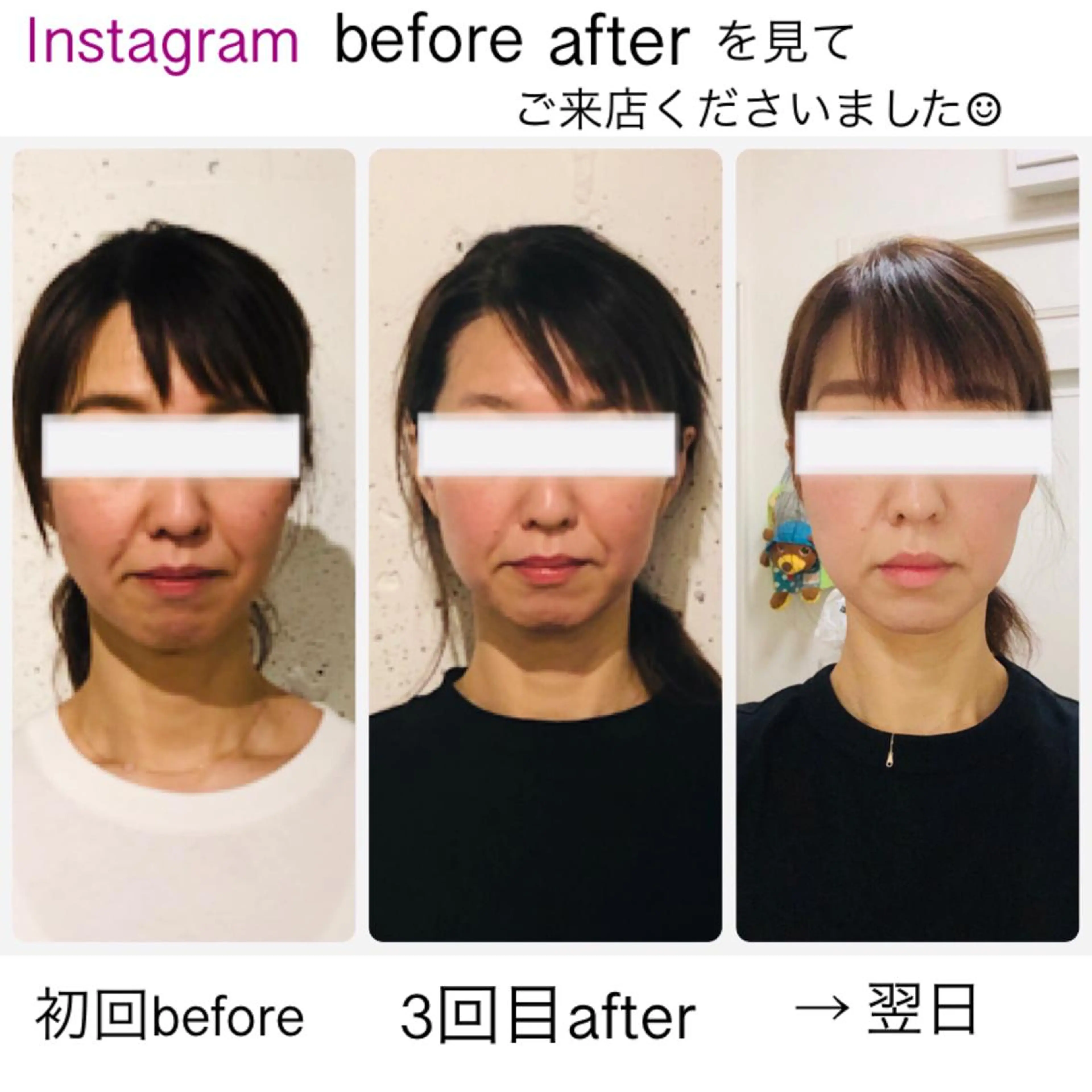 ミディアム ネイル マツエク・マツパ 小顔矯正専門サロンジュマリ所属・町田 淳子のエステ・リラクイメージ
