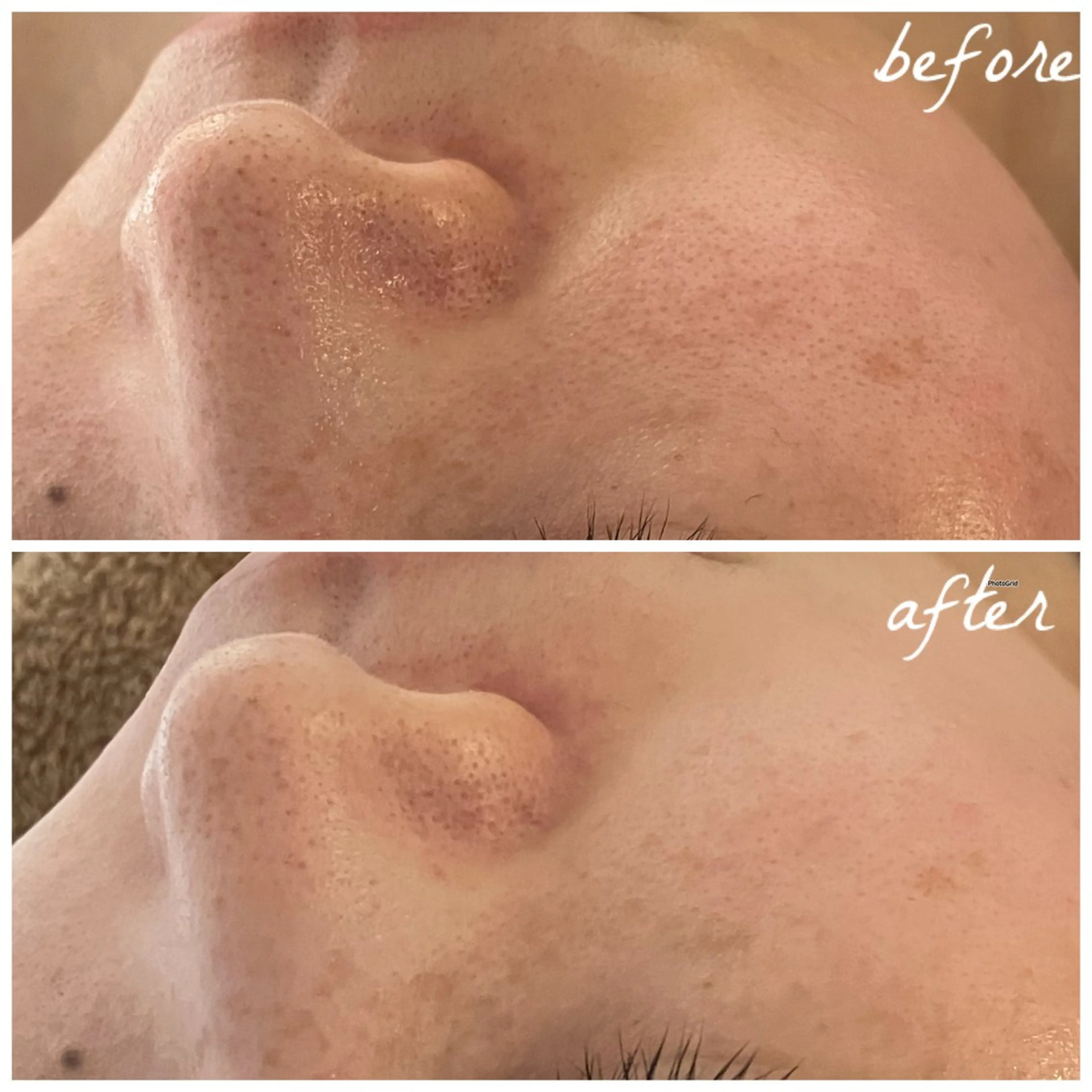 メンズ メナード岐阜茜部 杉浦のエステ・リラクイメージ