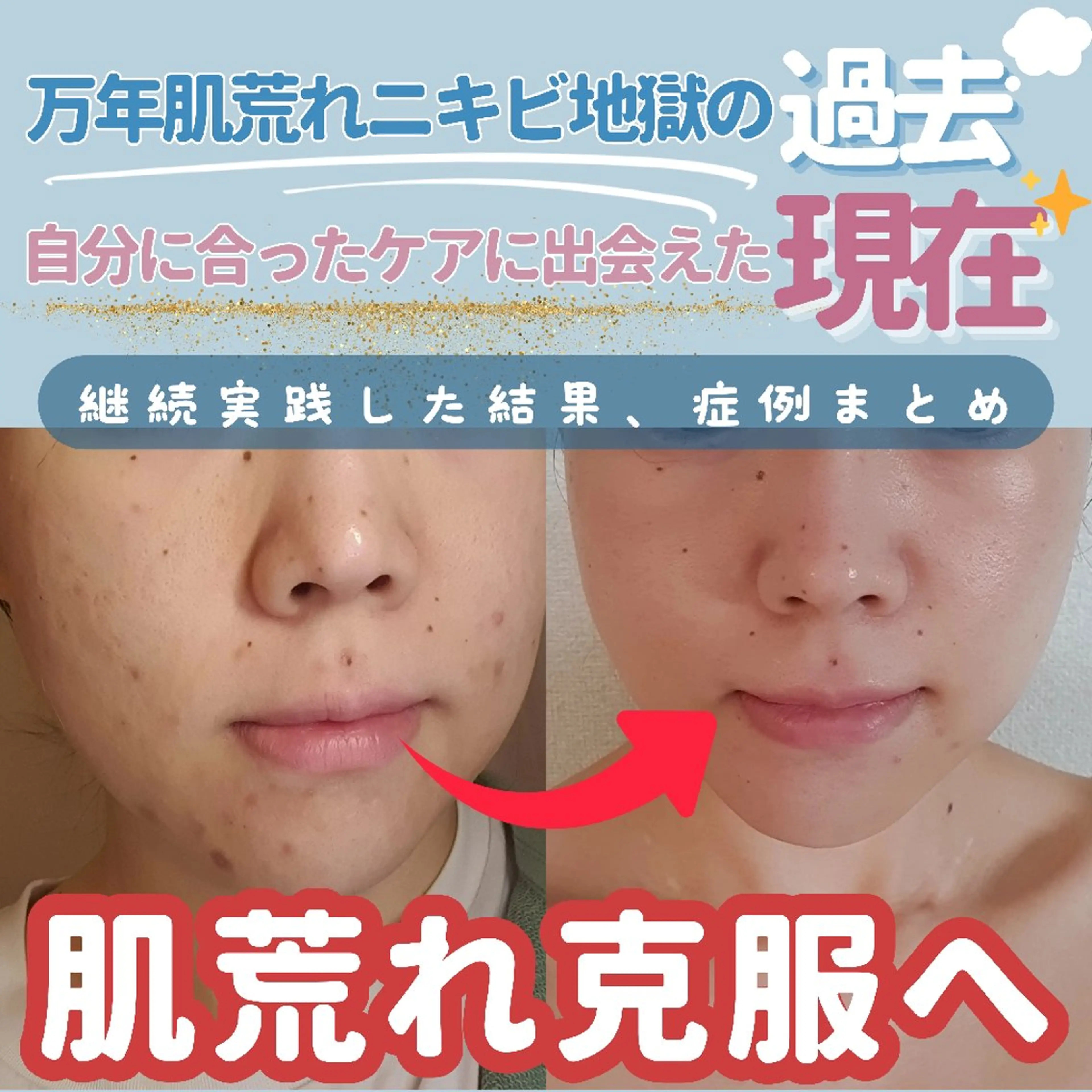 エステ リラク 痩身ハーブピーリング 筋膜リリース☆B&Hのエステ・リラクイメージ