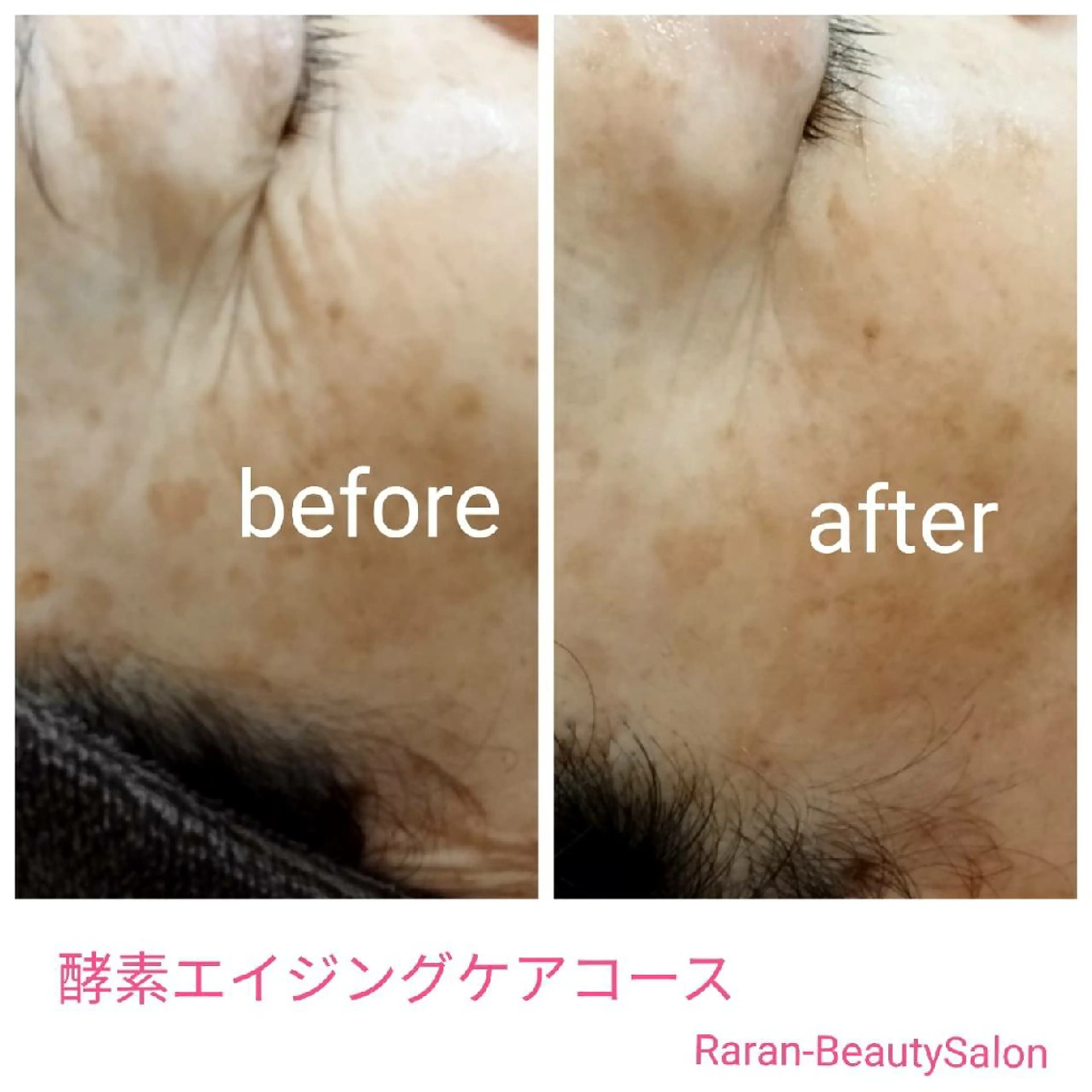 若返り 美肌   エステサロンららんのエステ・リラクイメージ