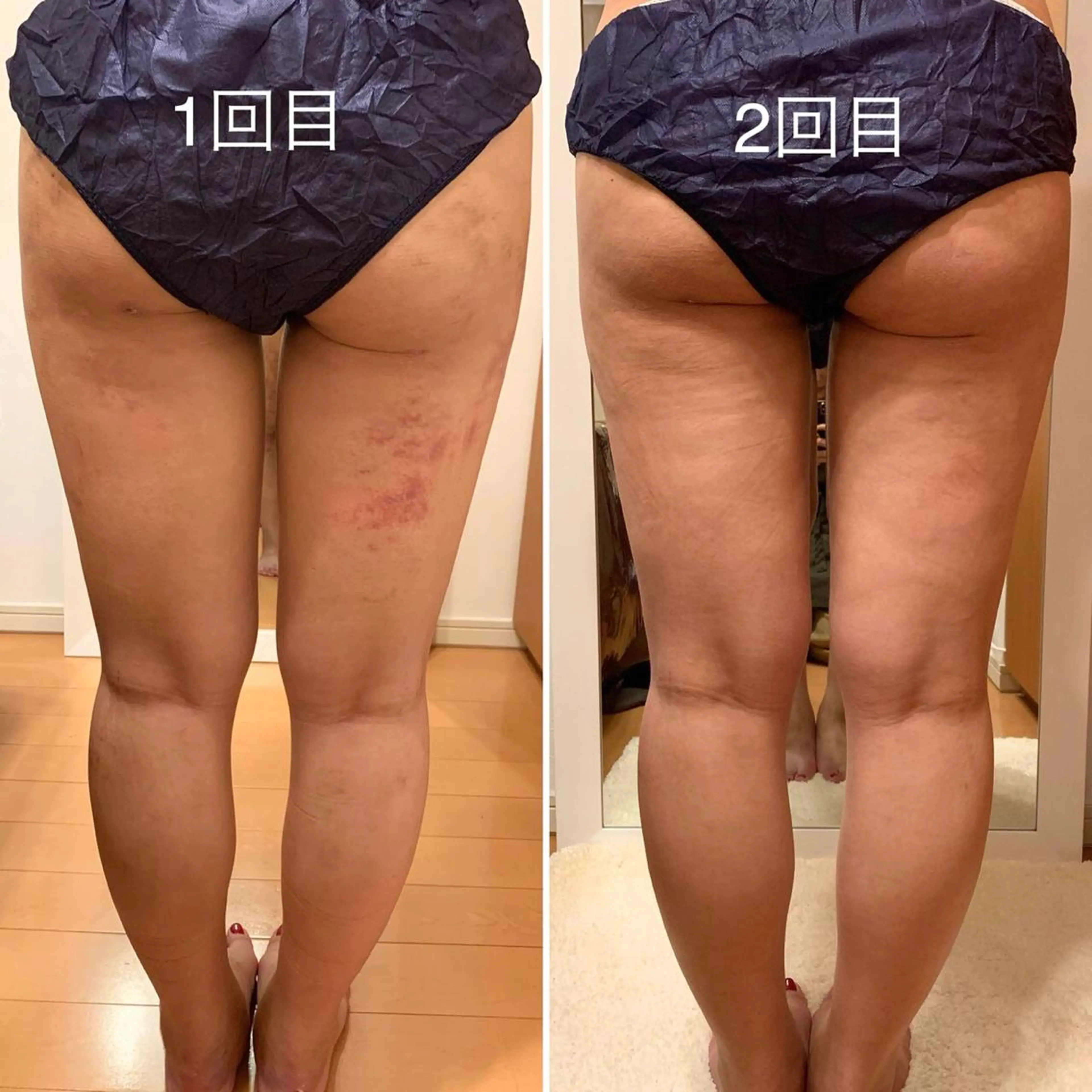 インディバベース あさみのエステ・リラクイメージ