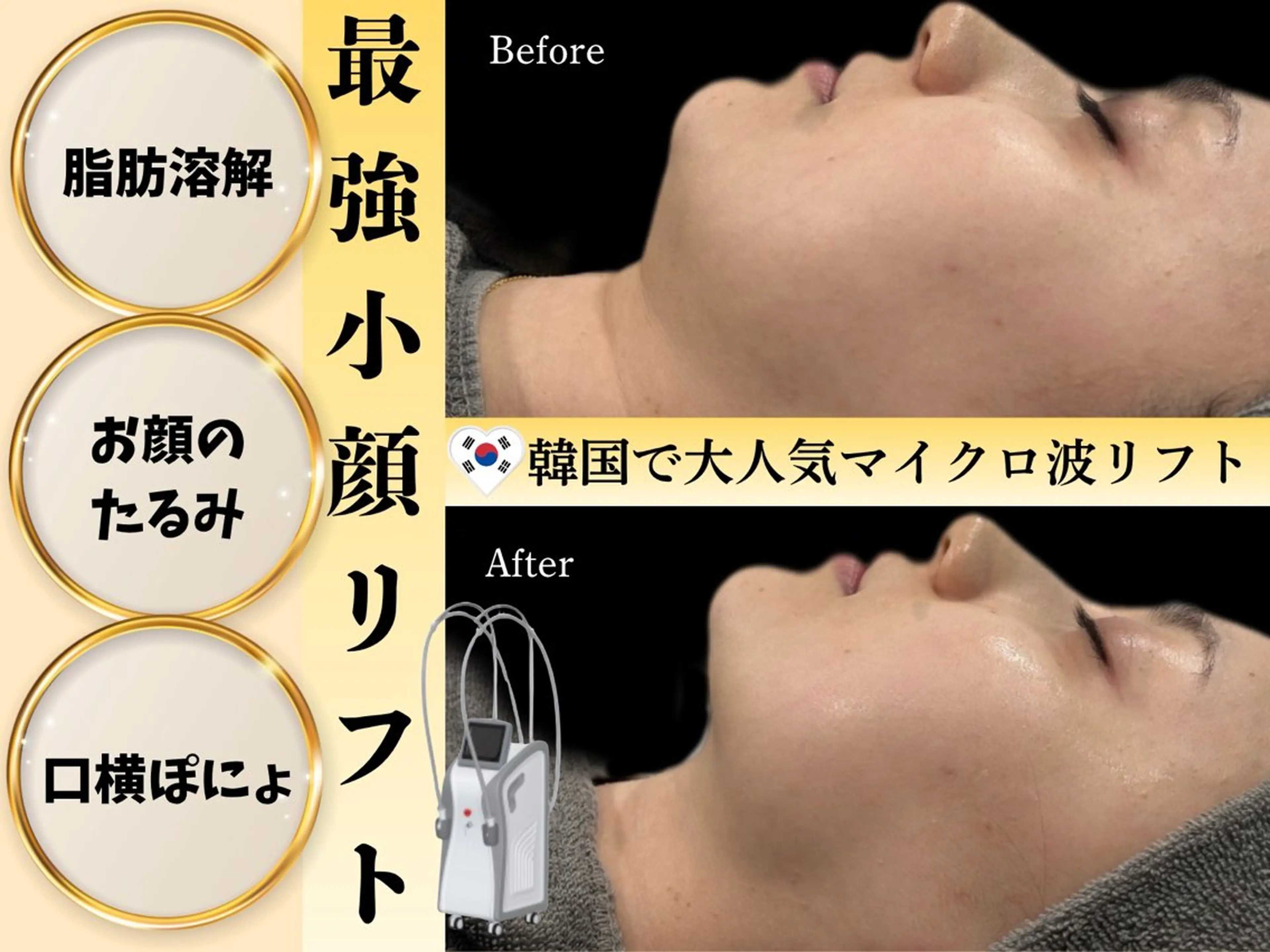 カンナムビューティー麻布十番店所属・bizz bizz 麻布十番🌿のその他イメージ