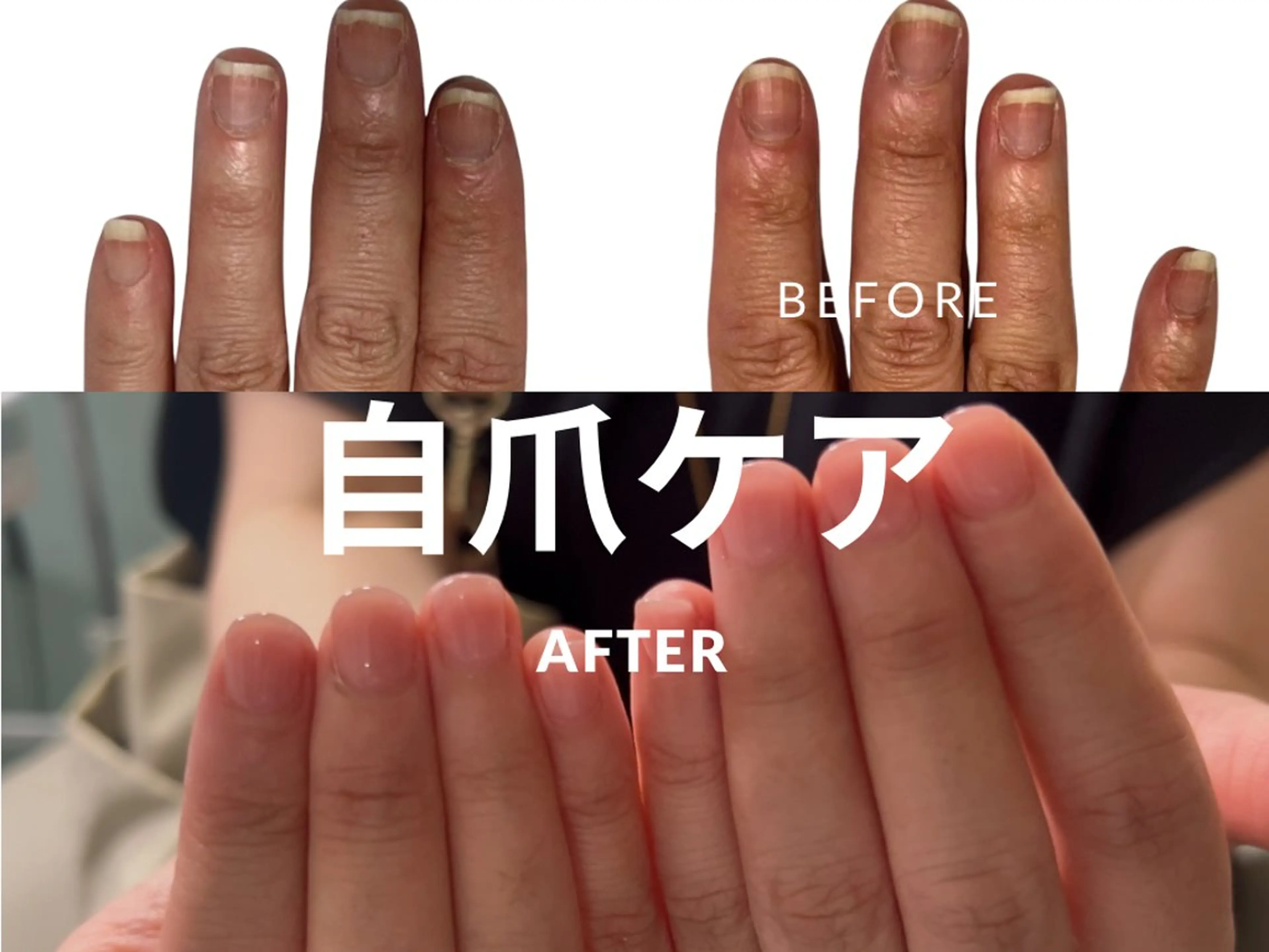 人気No.2【自爪ケア1回分】深爪自爪を伸ばしたい方/自爪育成/ジェルネイルで補強/ワンカラーorラメ※長さ出しなしの写真