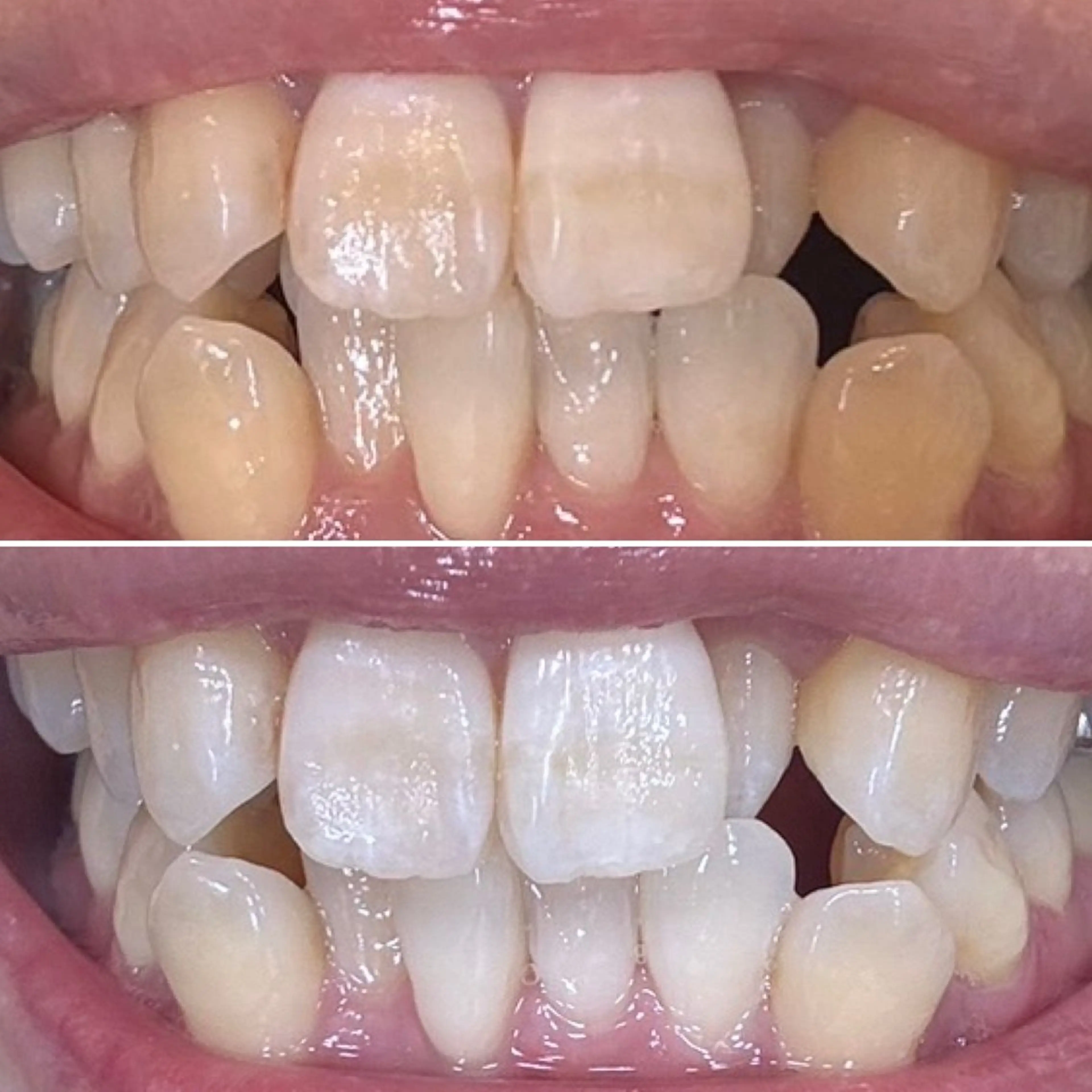 その他 soerute所属・soerute スタッフemiのエステ・リラクイメージ