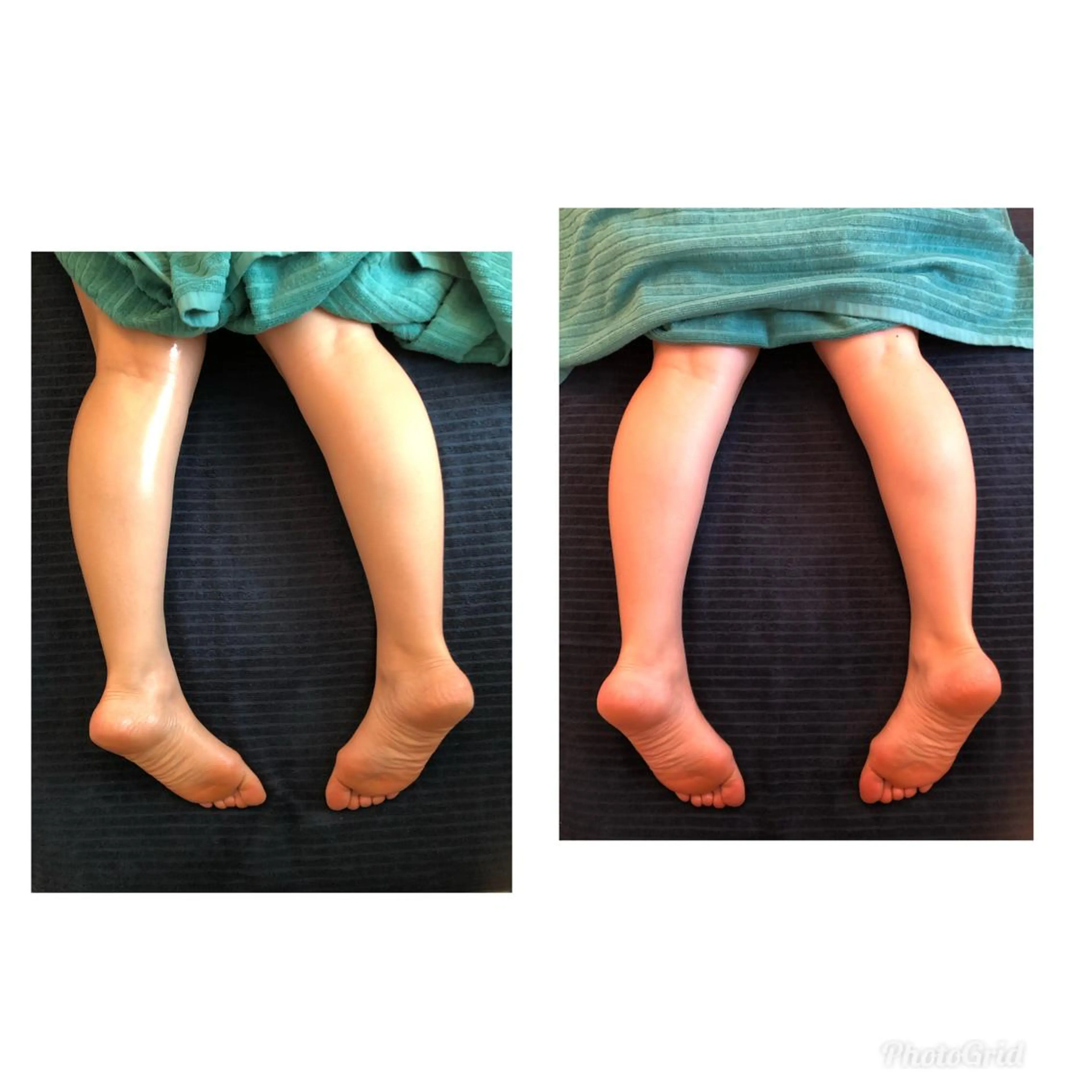 エステ リラク おうちサロン B-ROOMのエステ・リラクイメージ