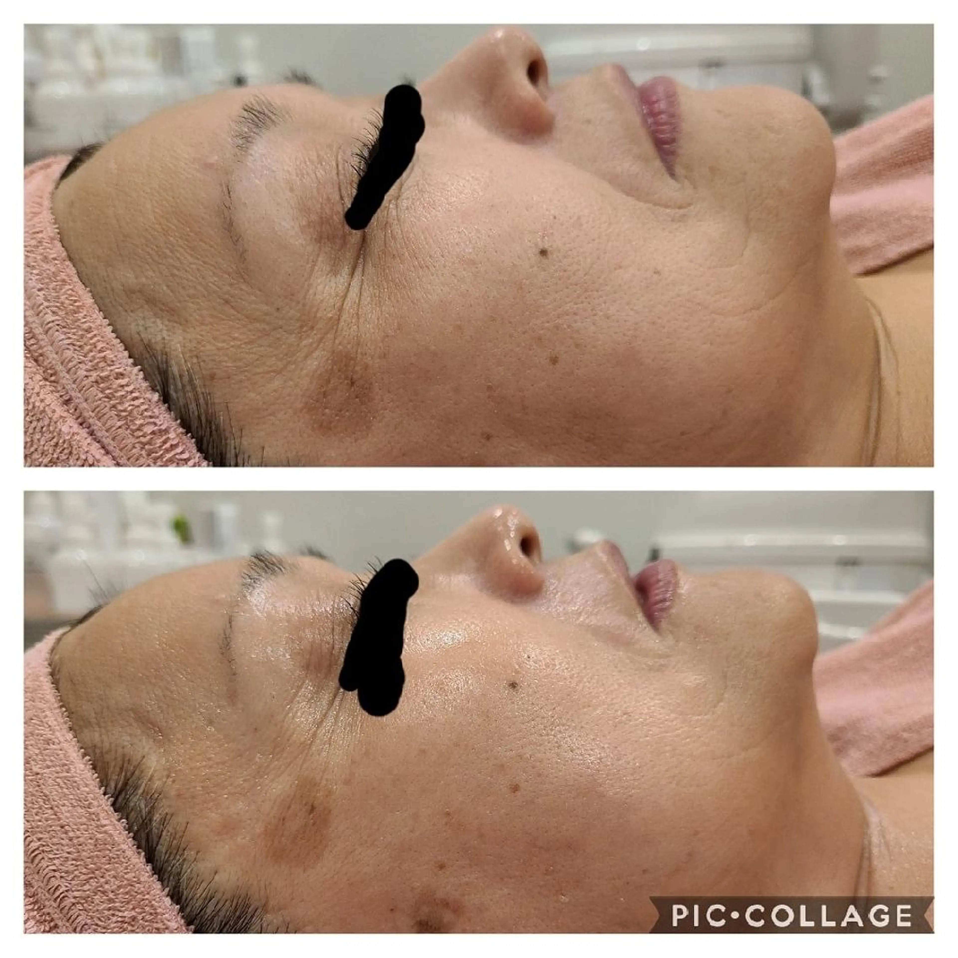 筋膜フェイシャルの写真