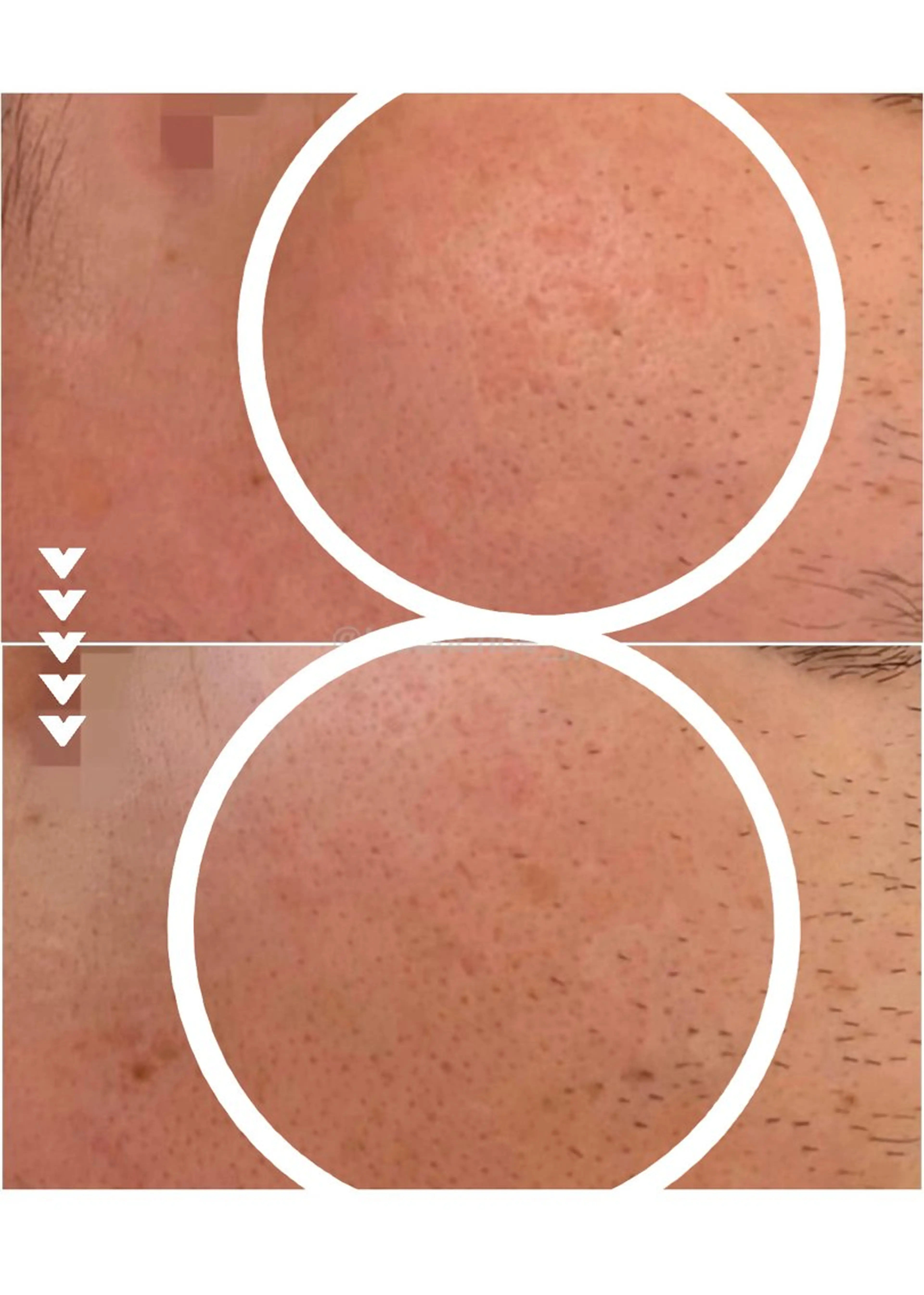 肌質改善 KALANCHOEのエステ・リラクイメージ