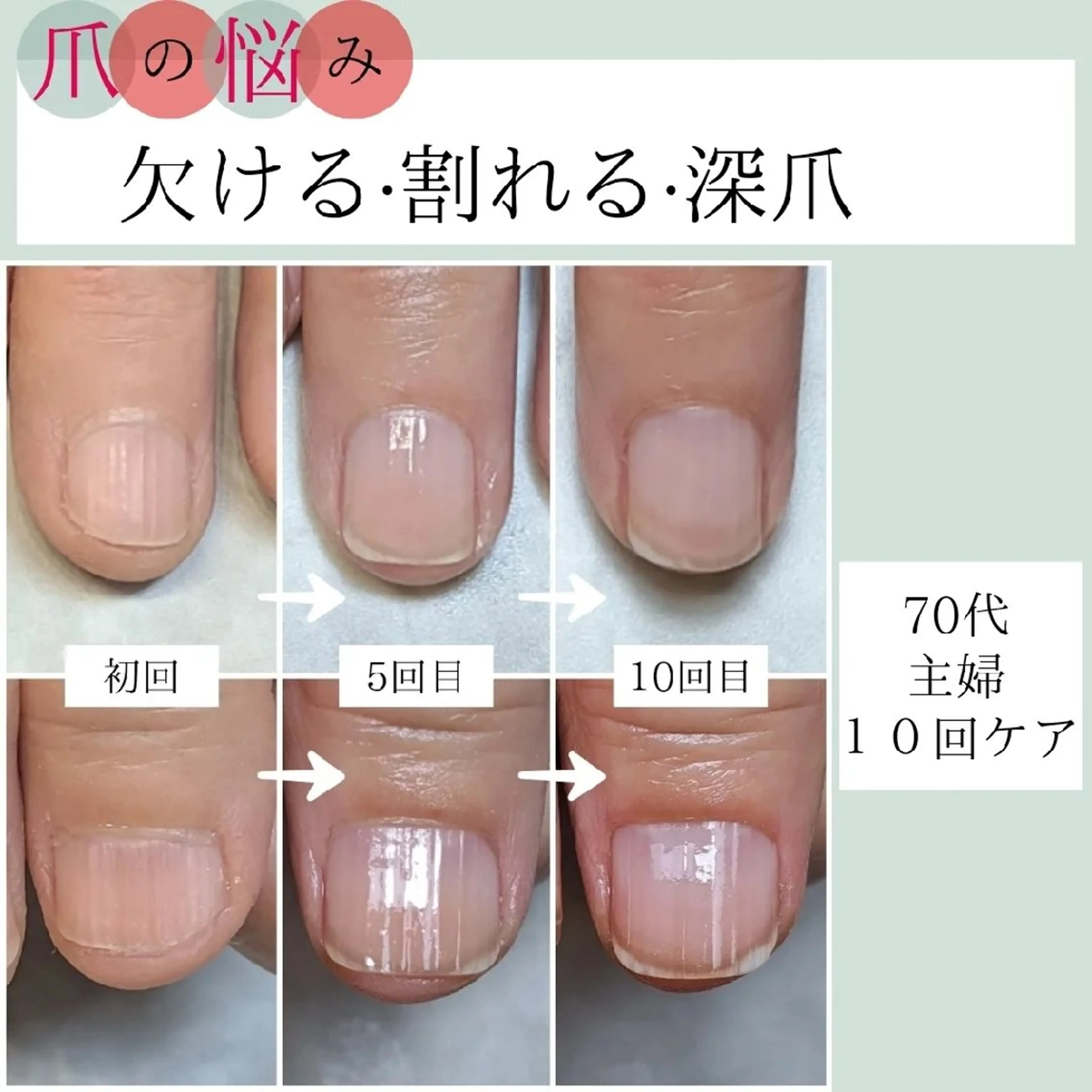 ネイル ハンドケア AKT NAIL所属・AKT Beauty ドライヘッドスパのネイルデザイン