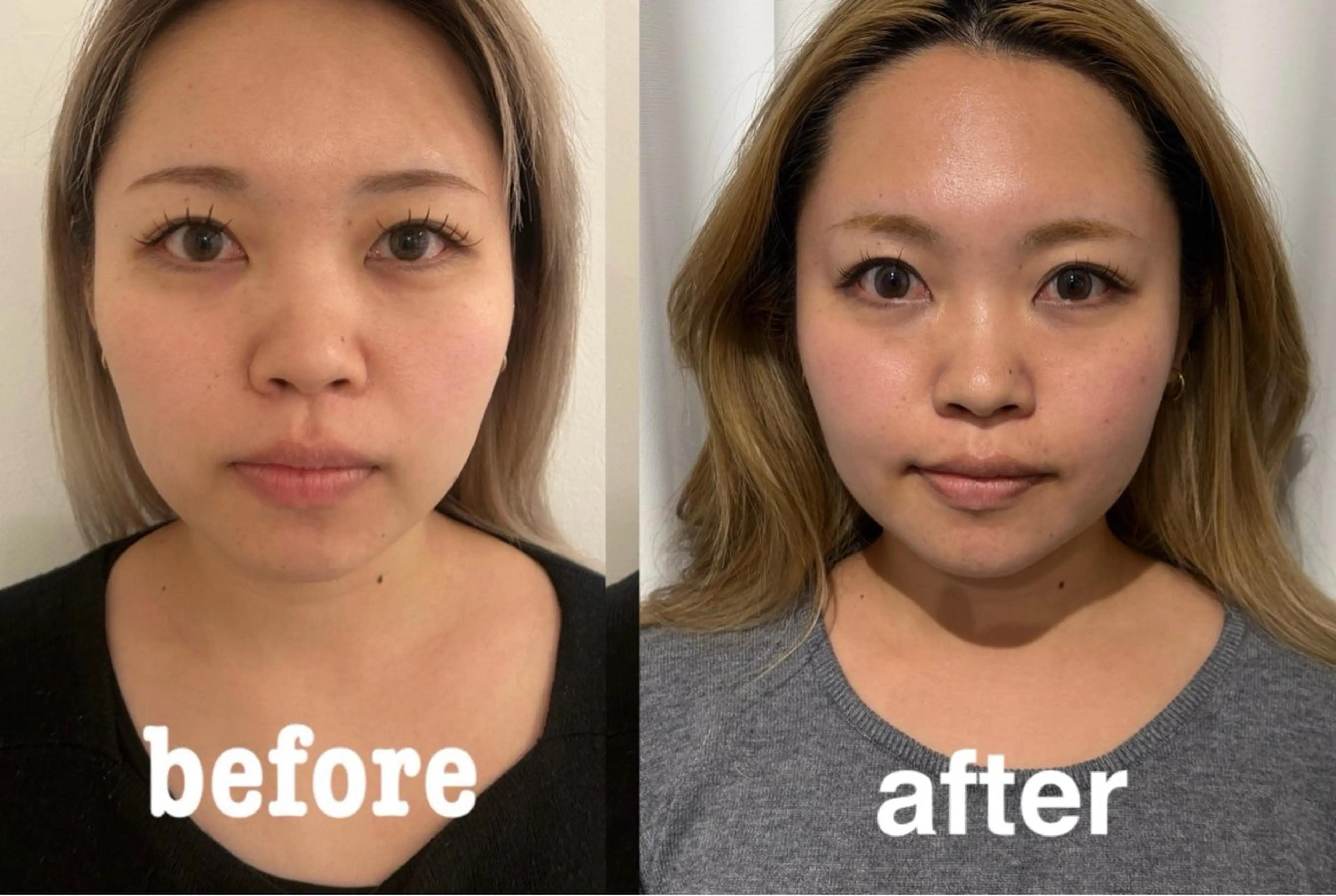 エステ リラク 美容鍼灸サロン mahoroba院長のエステ・リラクイメージ