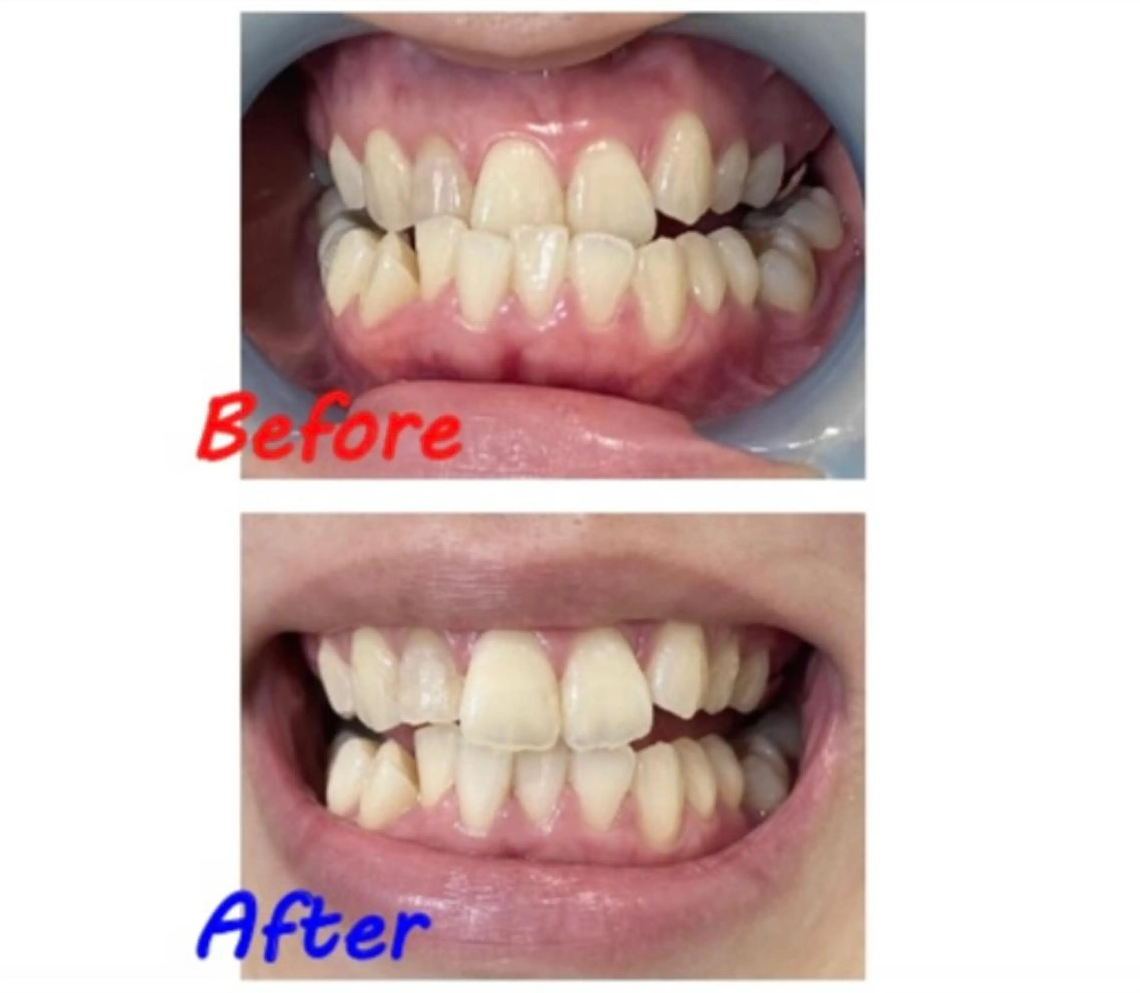 その他 セルフホワイトニングサロン　ラヴィアン所属・ホワイトニングサロン La vie enのその他イメージ