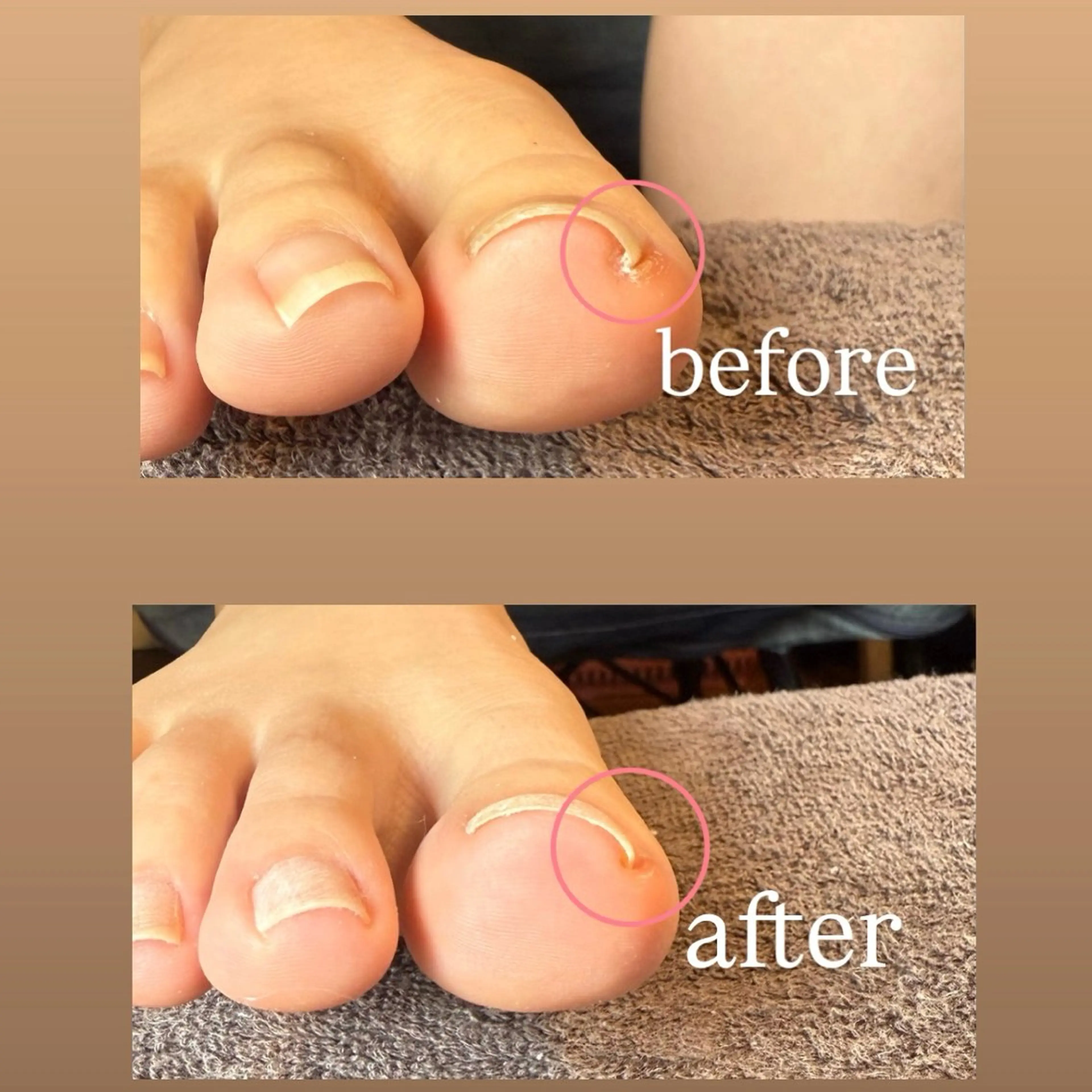 ネイル ジェルネイル フットネイル Welina nailのネイルデザイン