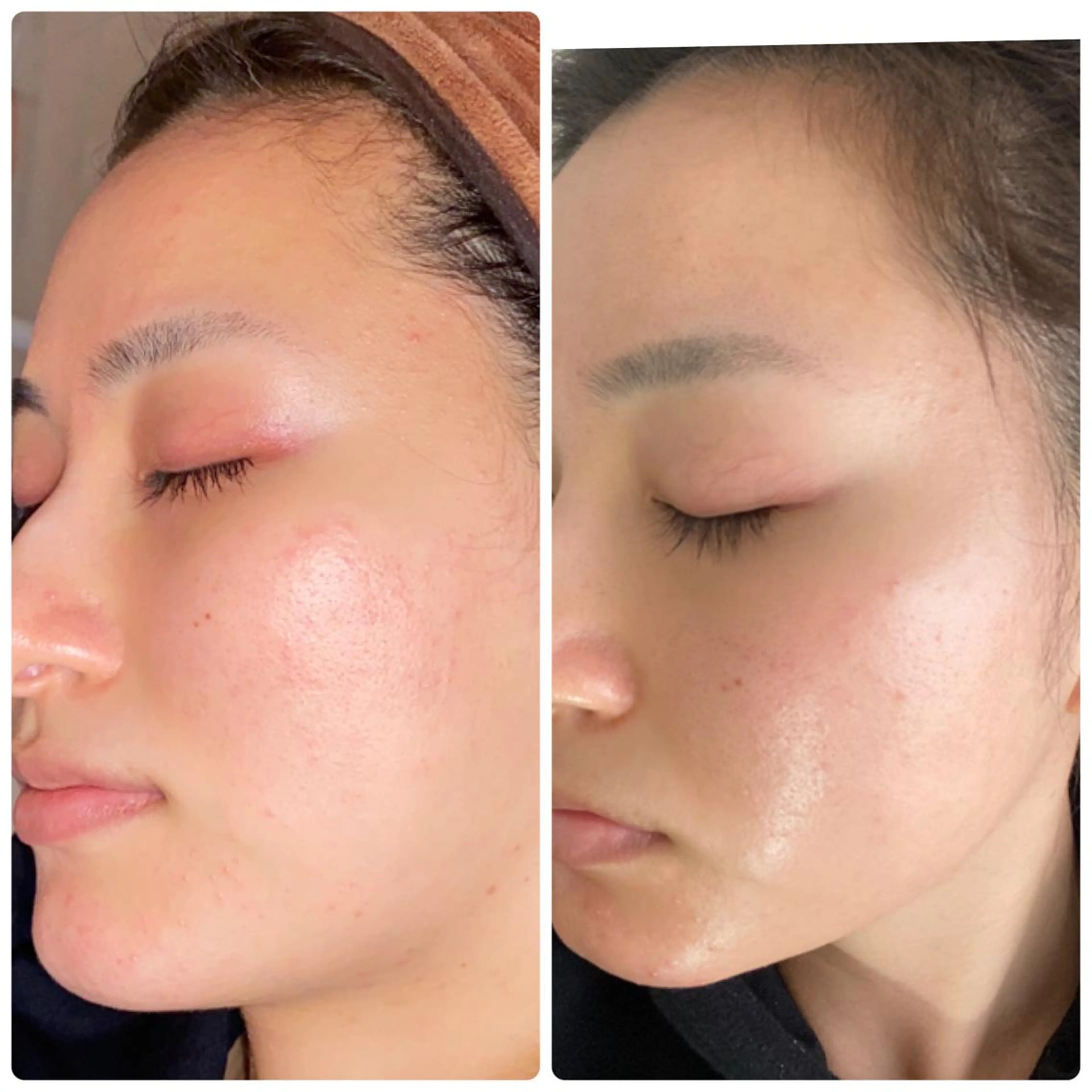 FLEUR大阪・整体 ・ハイフ・痩身・小顔のエステ・リラクイメージ