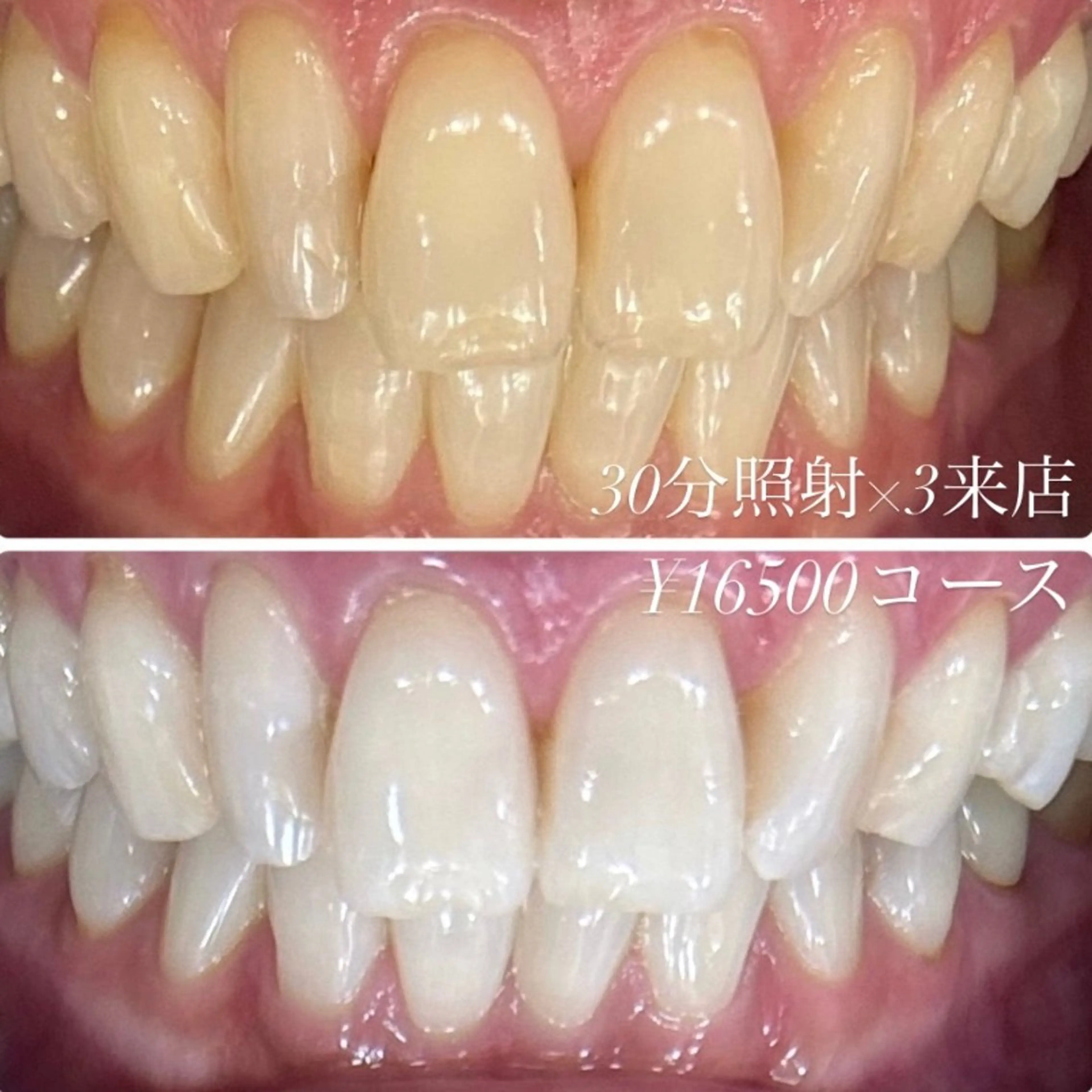 その他 ホワイトニングルーム 川崎店所属・ホワイトニング ルーム 川崎店のその他イメージ