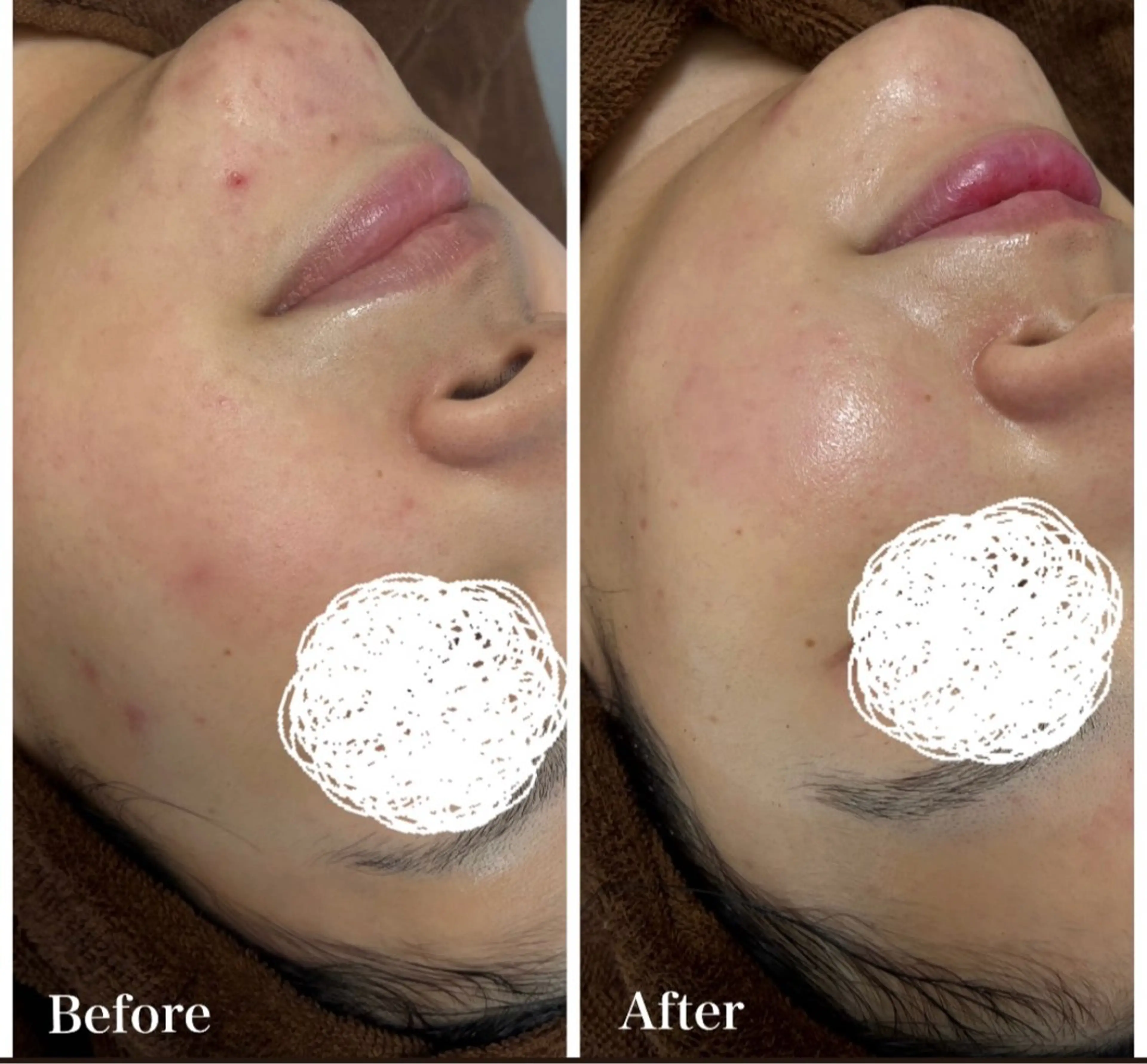 エステ Moena.所属・Moena. 武蔵小杉🫧のエステ・リラクイメージ