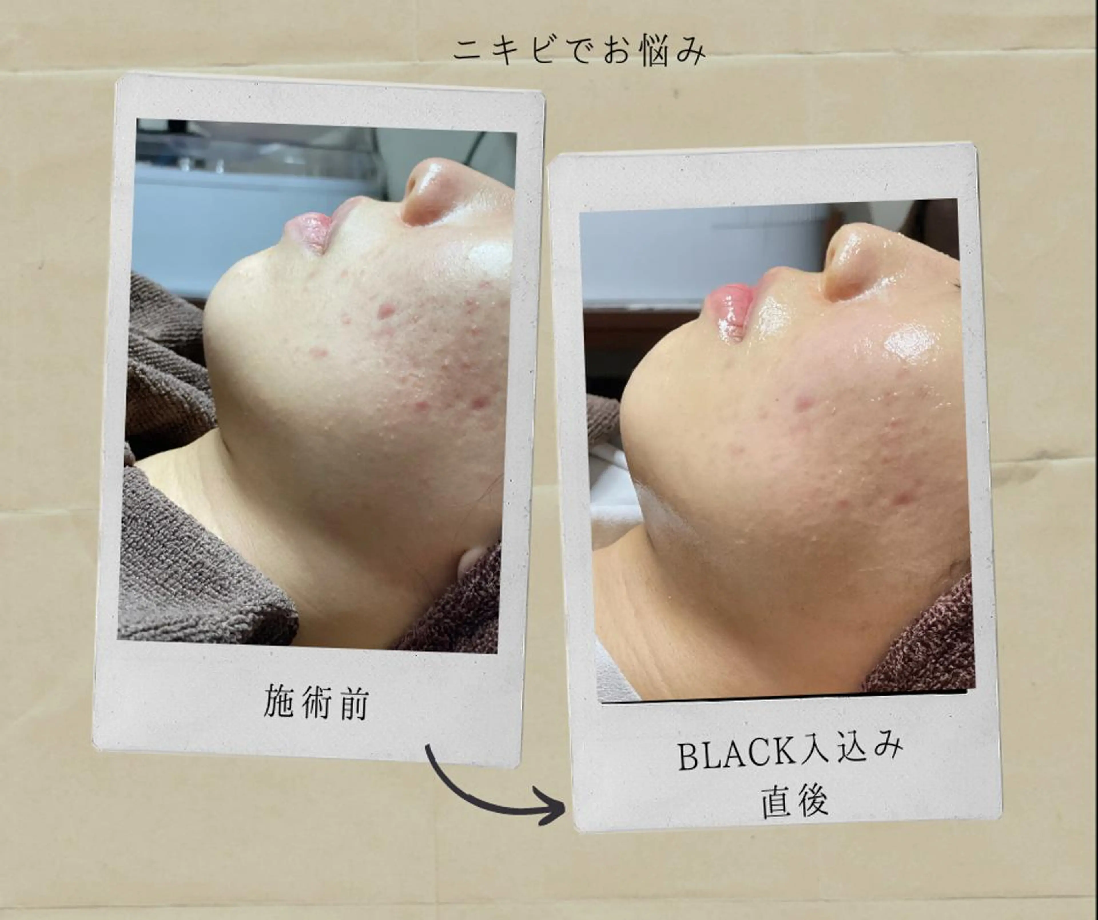 エステ 横浜private salonMOMOのエステ・リラクイメージ