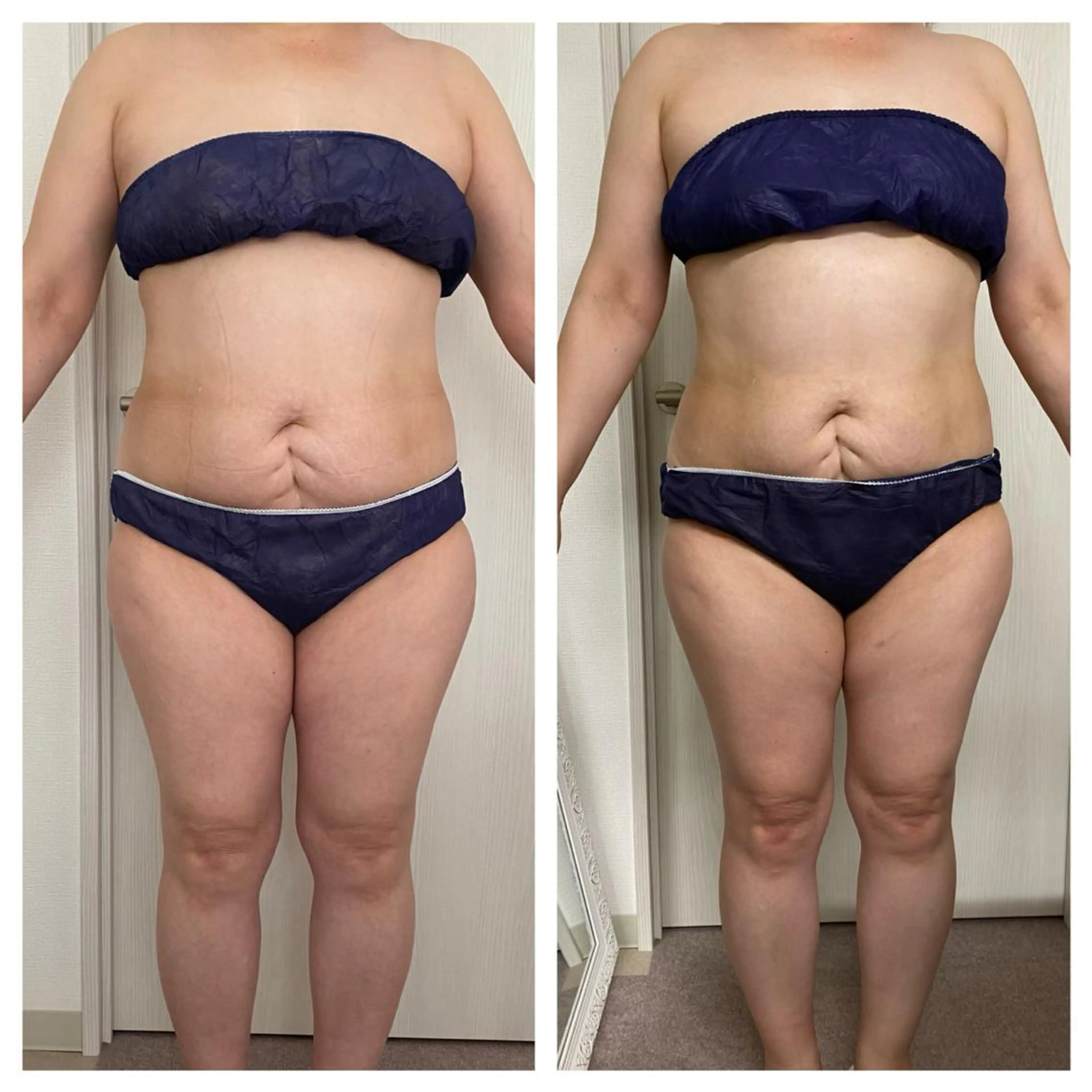 エステ 武藤 千裕のエステ・リラクイメージ