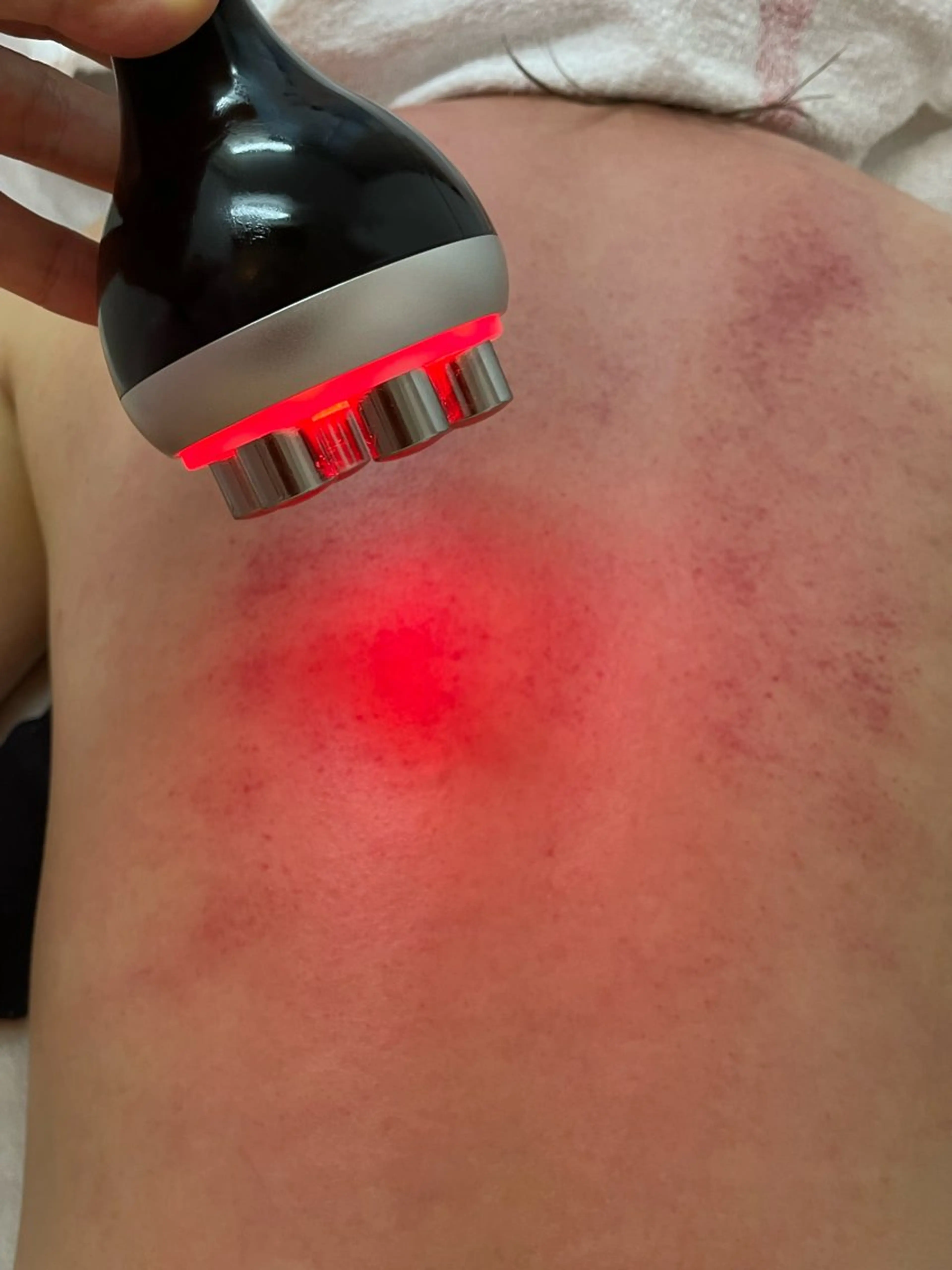 ニキビ、痩身、脱毛、 サクラチャンスパのエステ・リラクイメージ