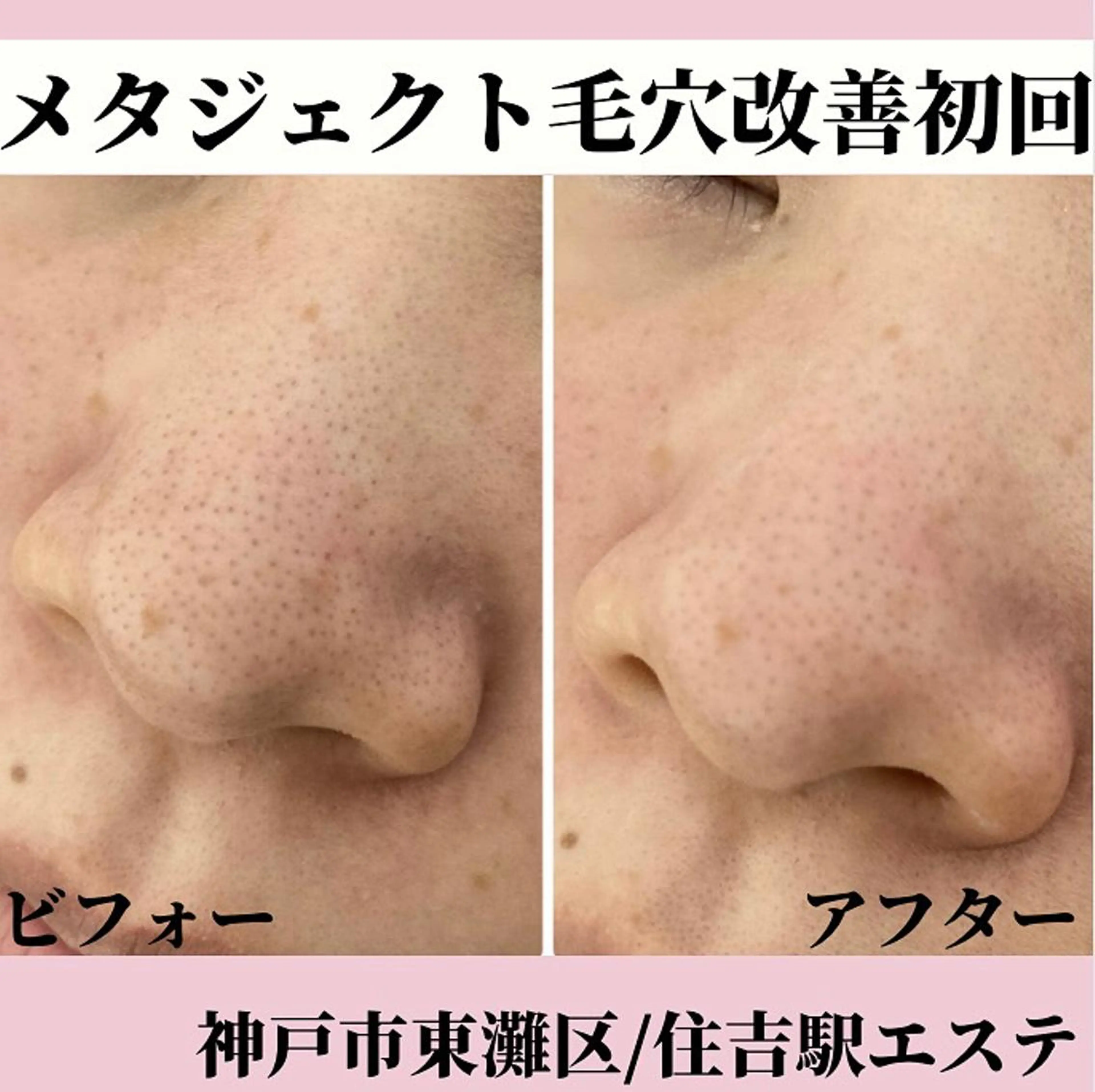 Salonde ELSA／河合のエステ・リラクイメージ