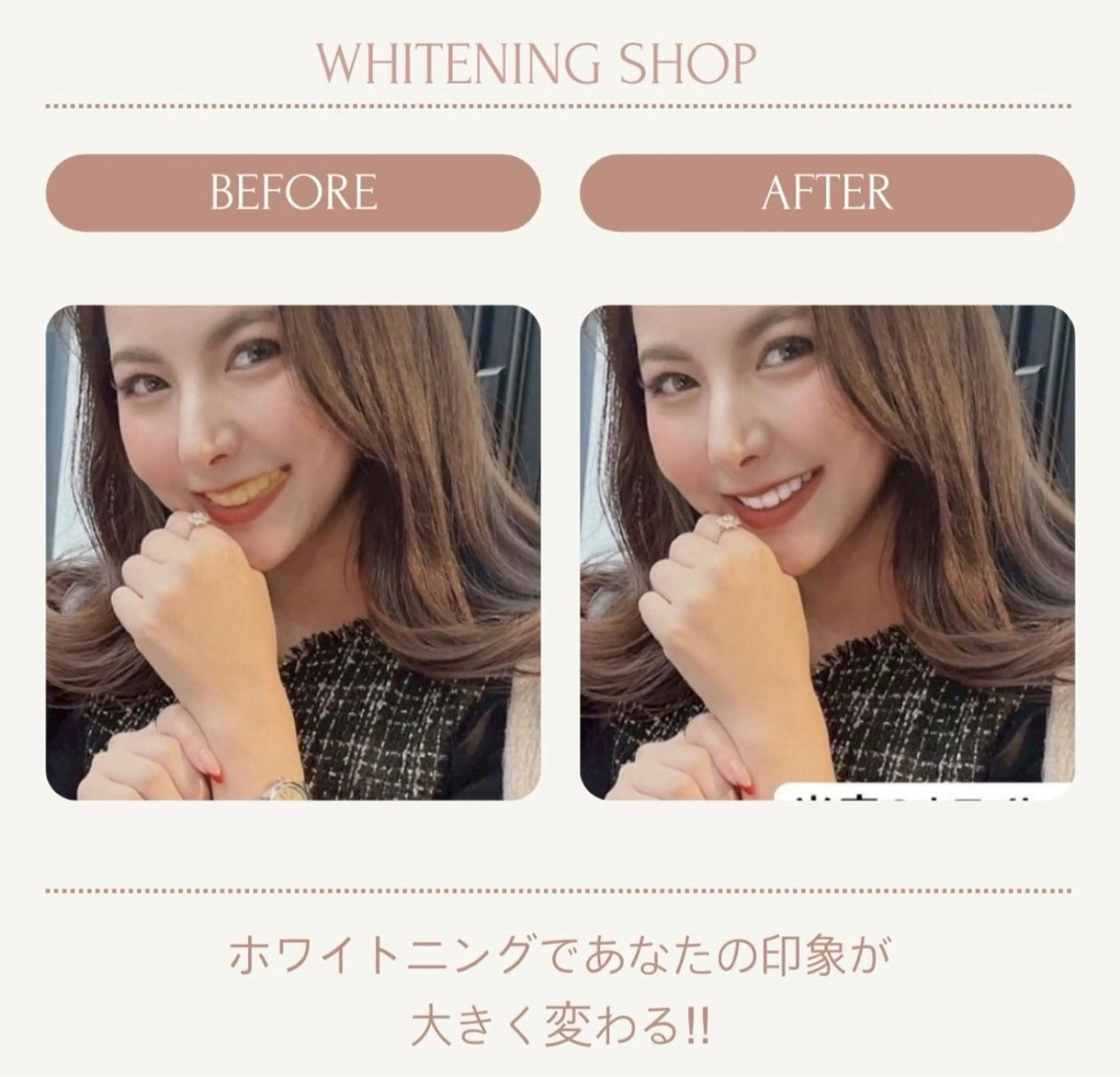 その他 セルフホワイトニングショップ静岡葵区店所属・もえか静岡葵区店ホ ワイトニングショップのその他イメージ