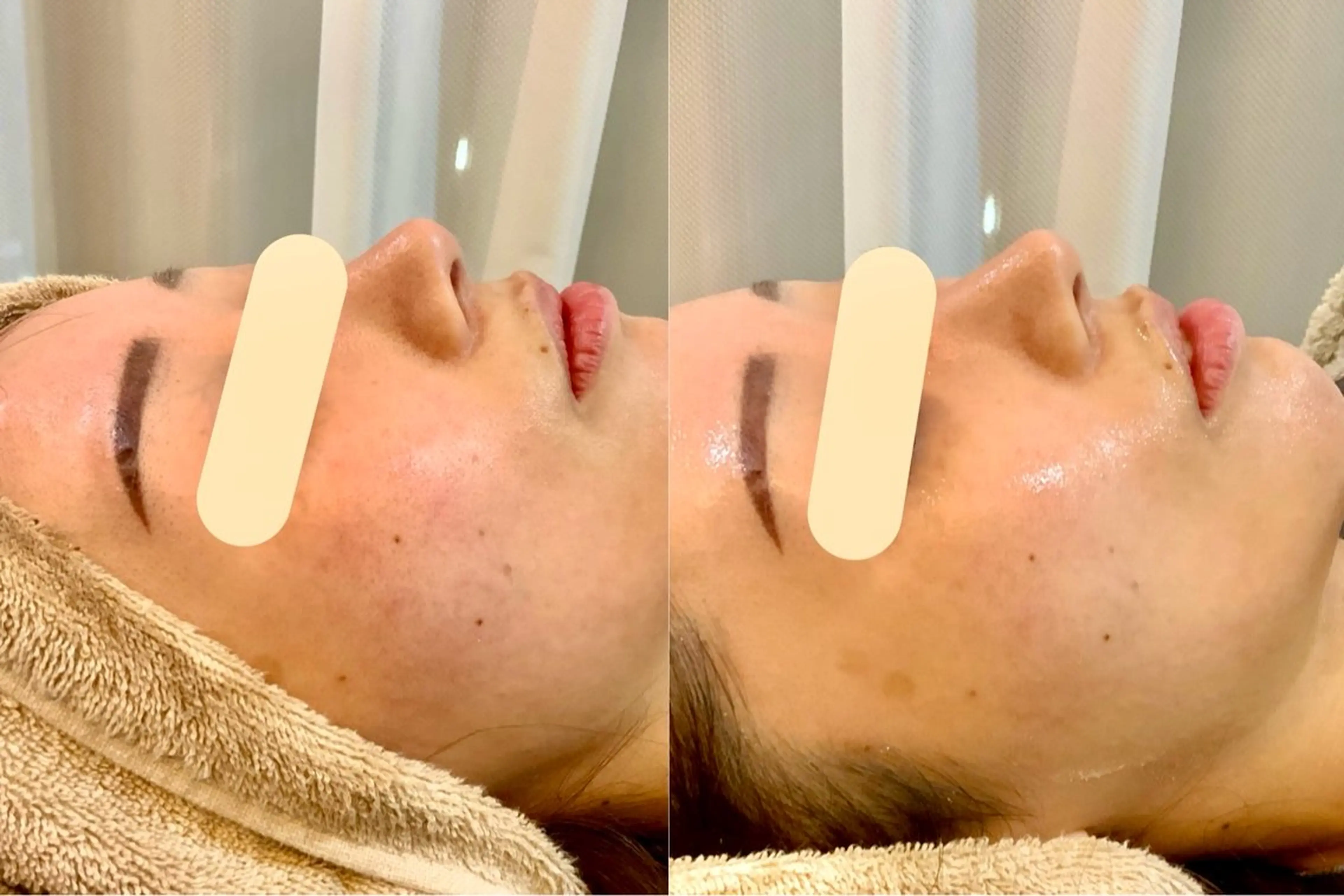 エステ 小顔・肌質改善 espoir 心斎橋のエステ・リラクイメージ