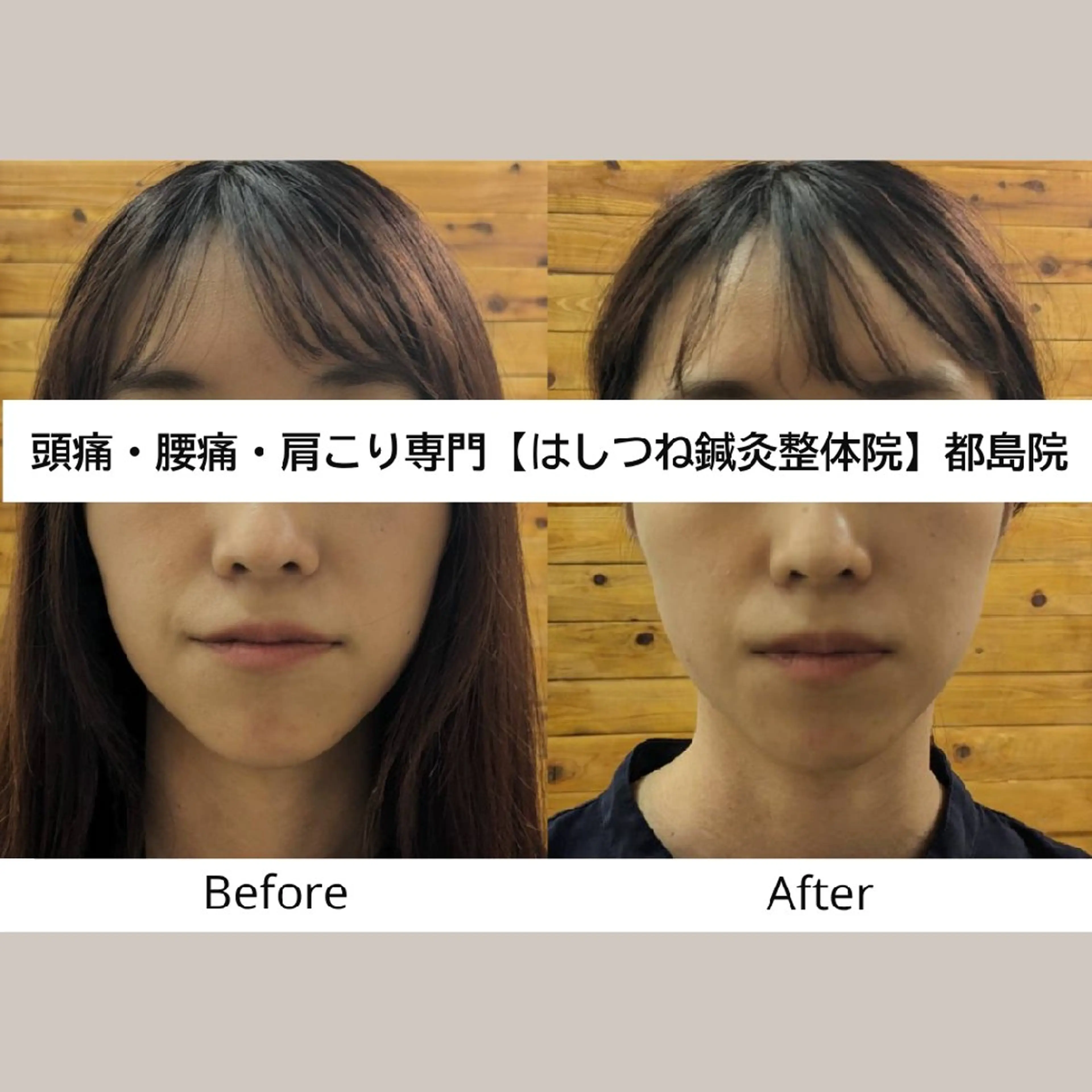 リラク 頭痛・腰痛・美容鍼に 特化してます。　橋岡のエステ・リラクイメージ