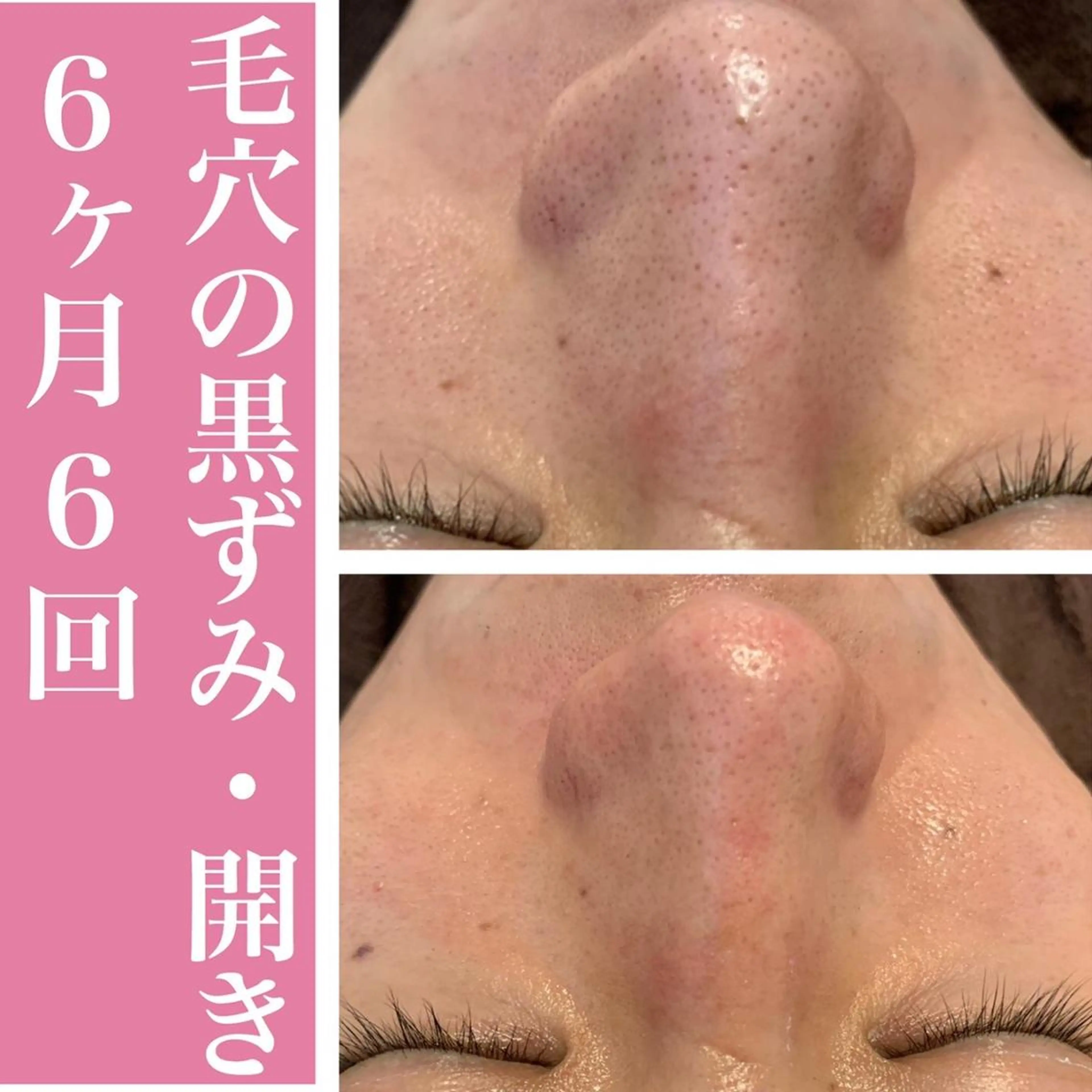 憧れのすっぴん韓流肌 🤎肌管理専門エステのエステ・リラクイメージ