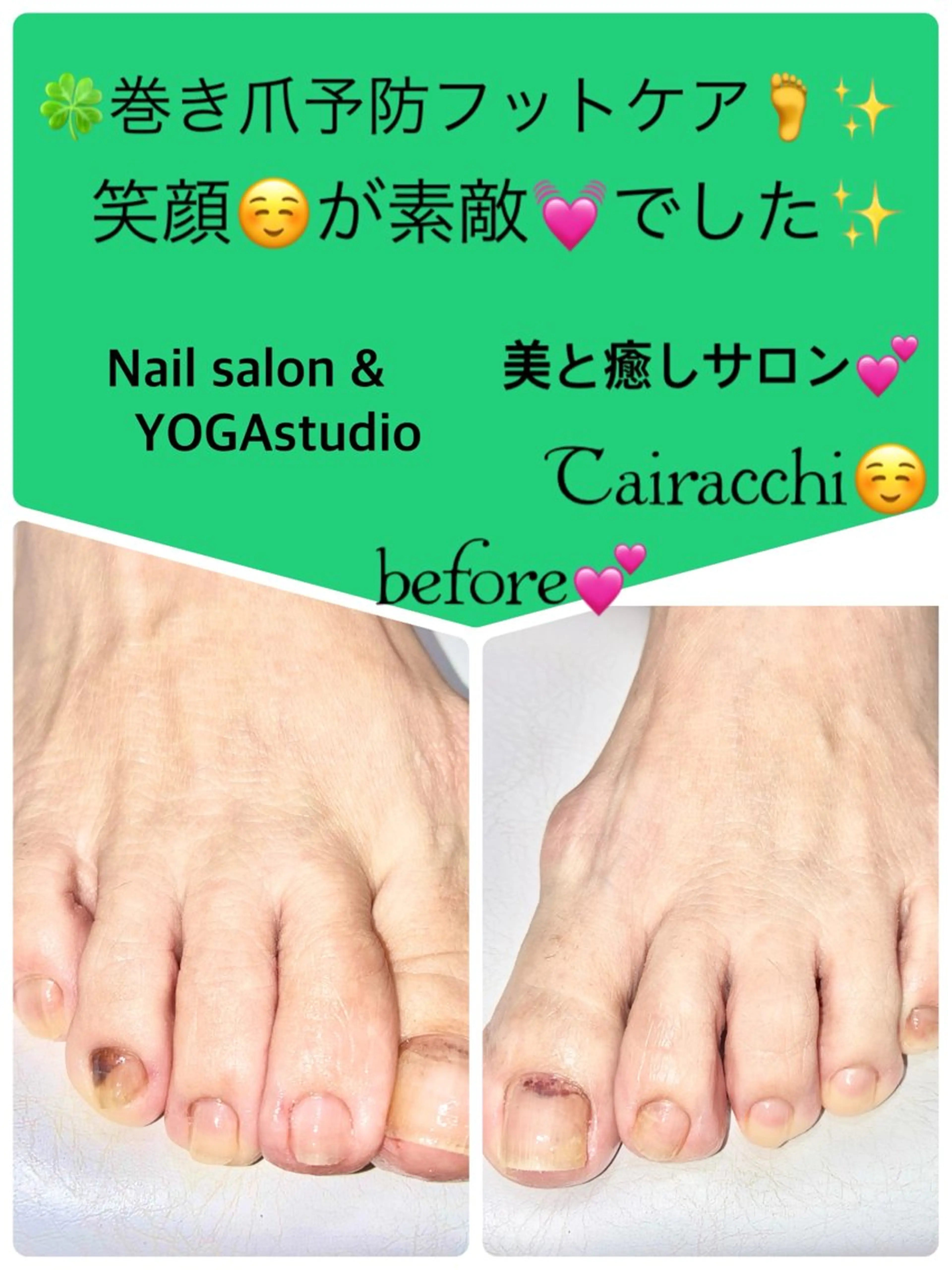 ネイル フットネイル フットネイル Tairacchi ﾀｲﾗｯﾁのエステ・リラクイメージ