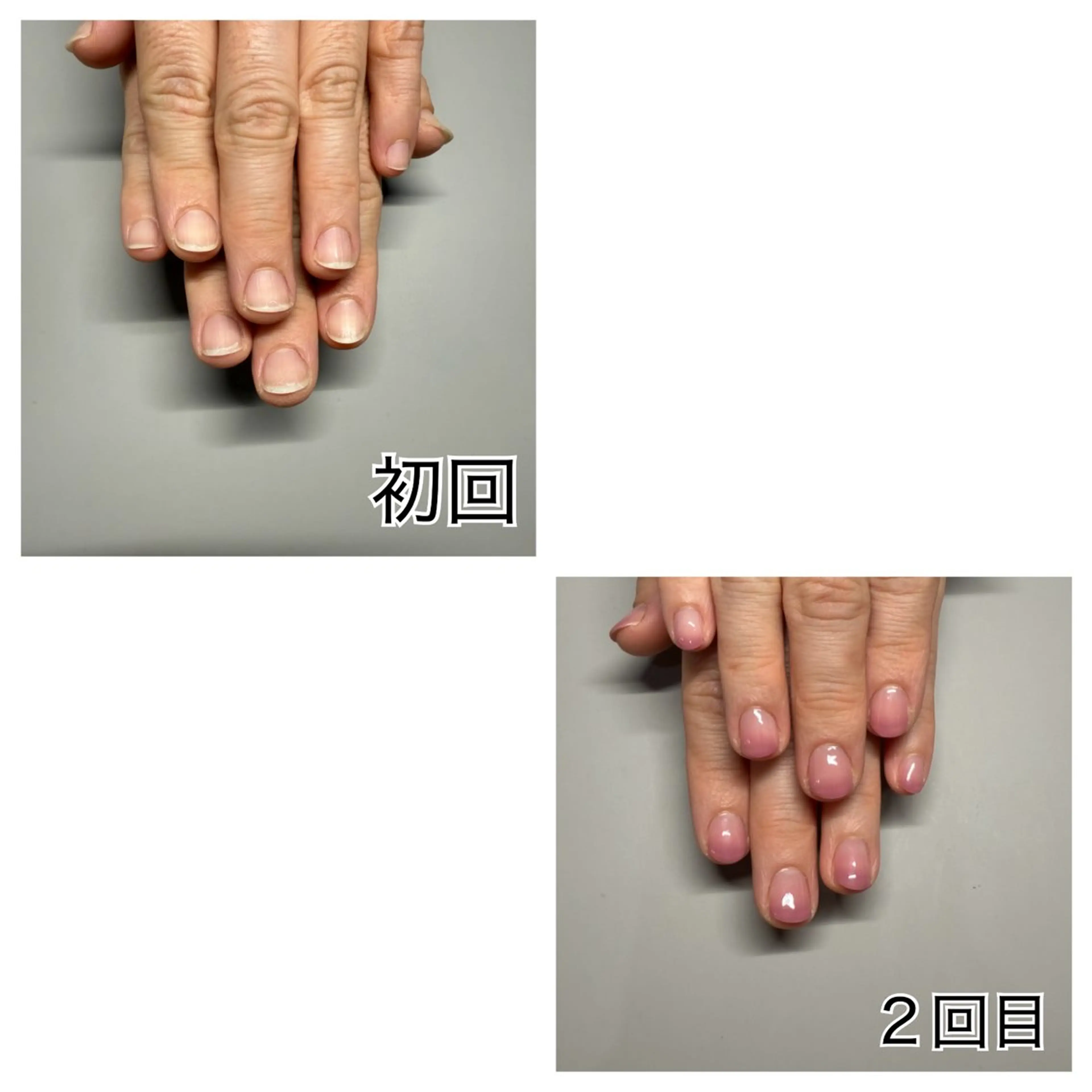 深爪予防・美爪育成　ワンカラーの写真