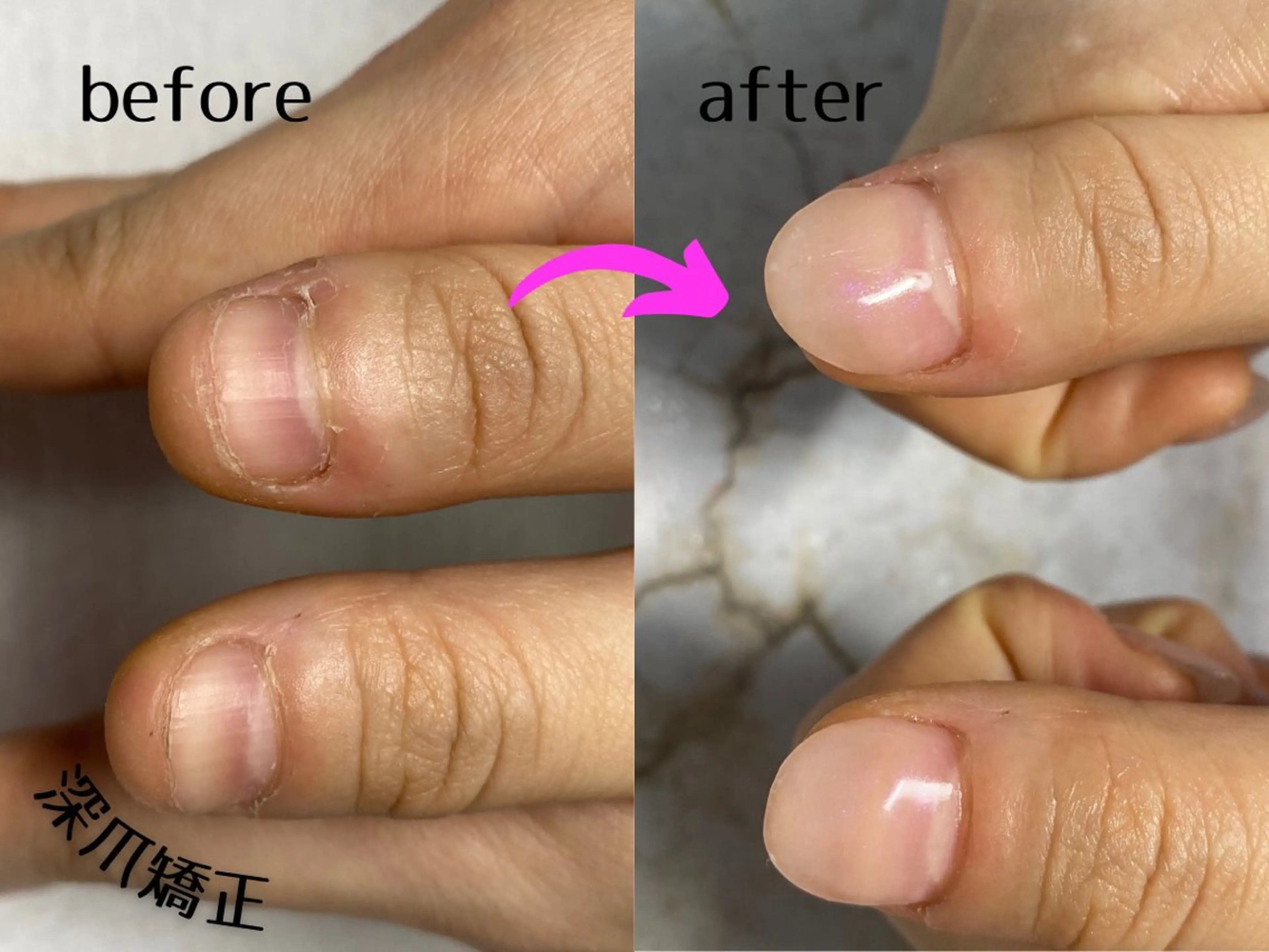 ネイル No&33所属・No&33 nail salonのエステ・リラクイメージ