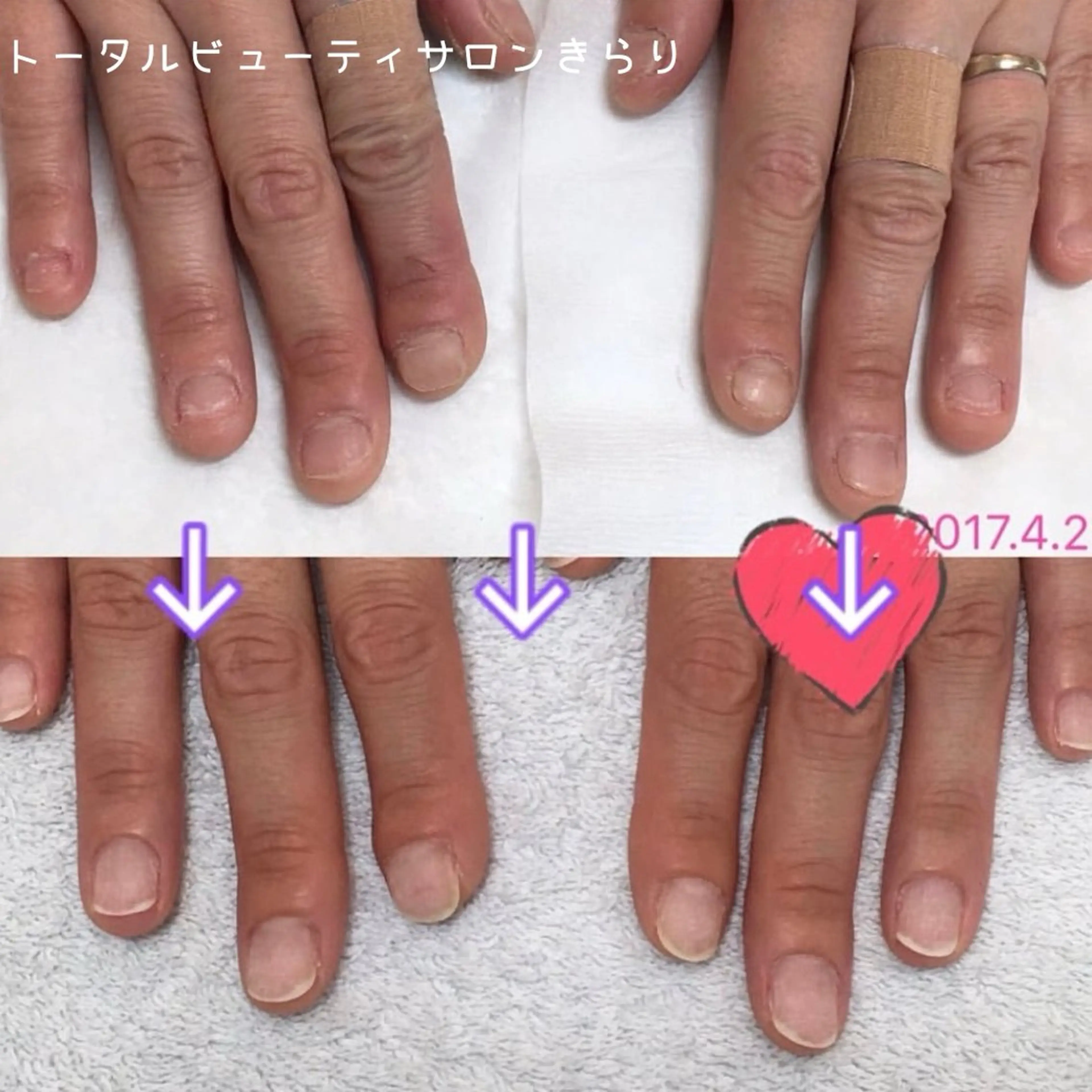 ネイル 那波 詩野のネイルデザイン