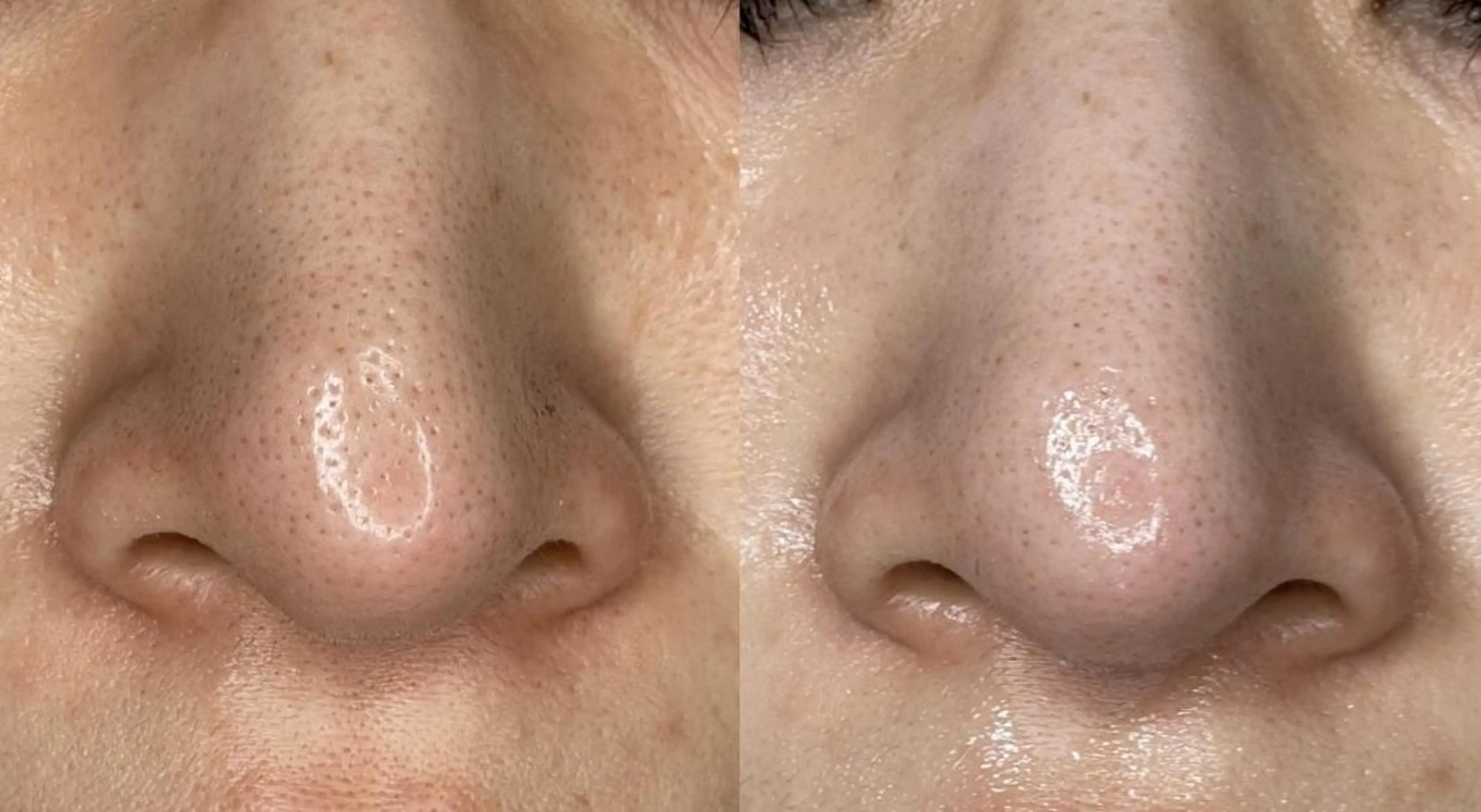 エステ sii センター北 AIのエステ・リラクイメージ