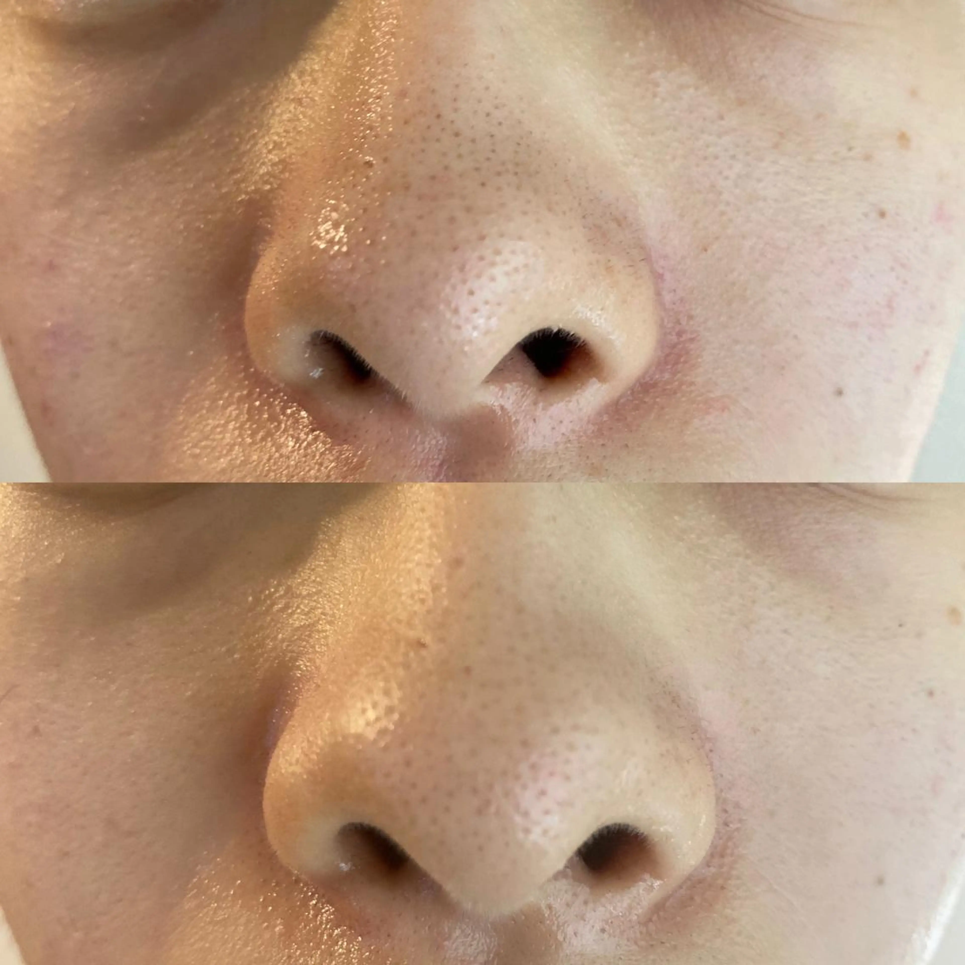 Meetite 小林のエステ・リラクイメージ