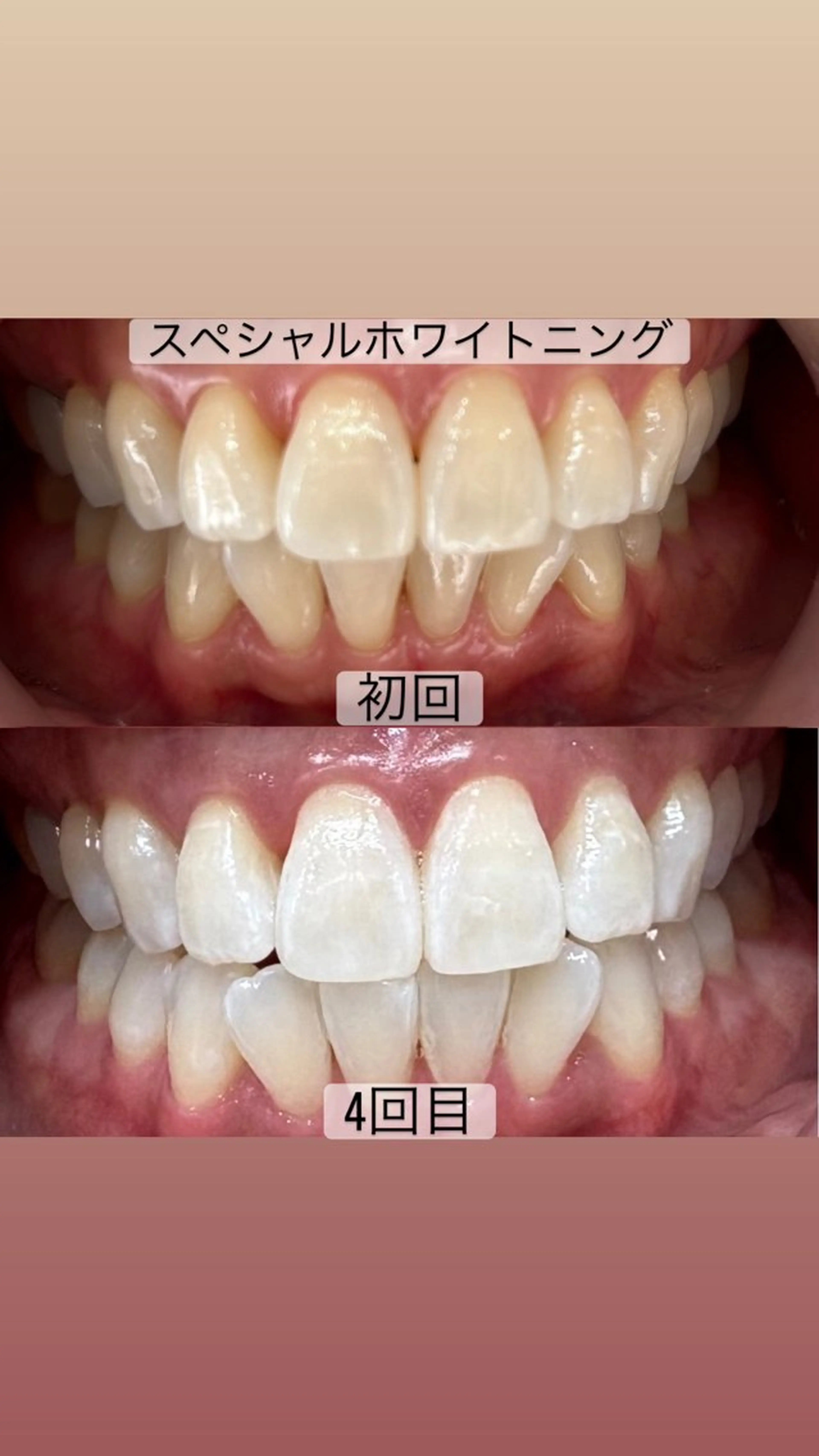 その他 whitening salon yatto.所属・ホワイトニングサロン yatto.のその他イメージ