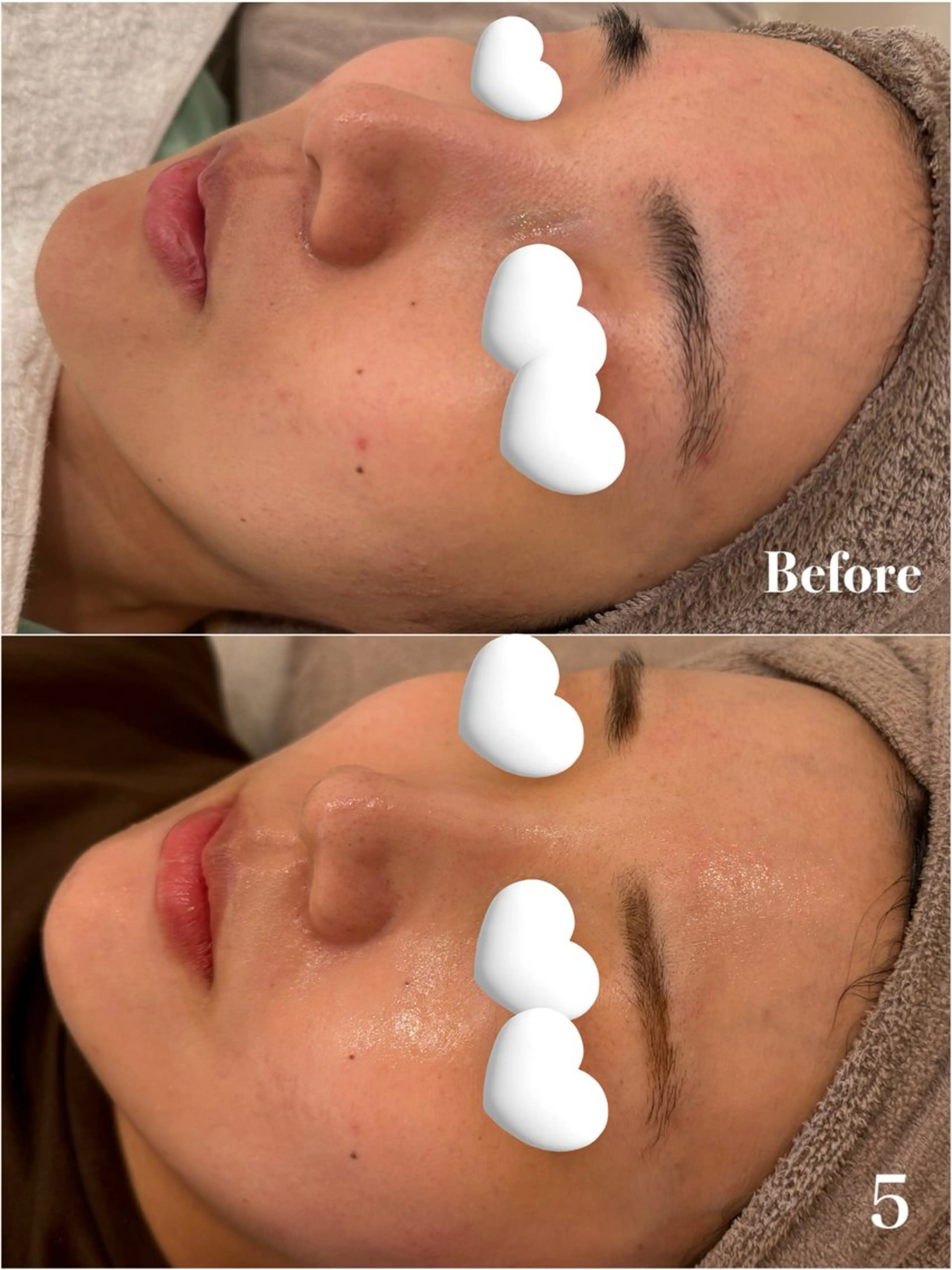 エステ Ayaka🤍 恵比寿/美容鍼/整体のエステ・リラクイメージ