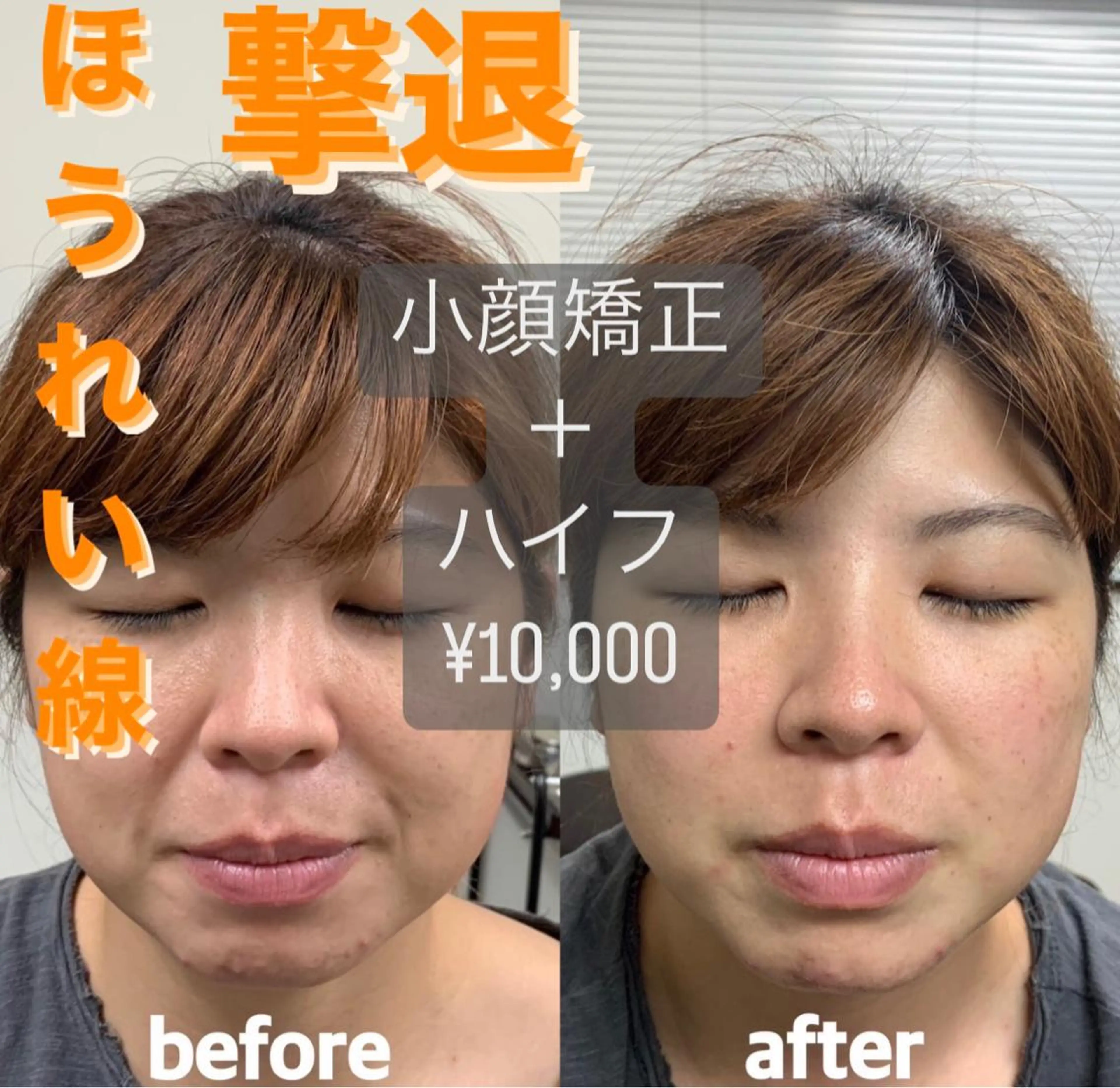 そノさき所属・大阪のシーサー🦁 島袋のエステ・リラクイメージ