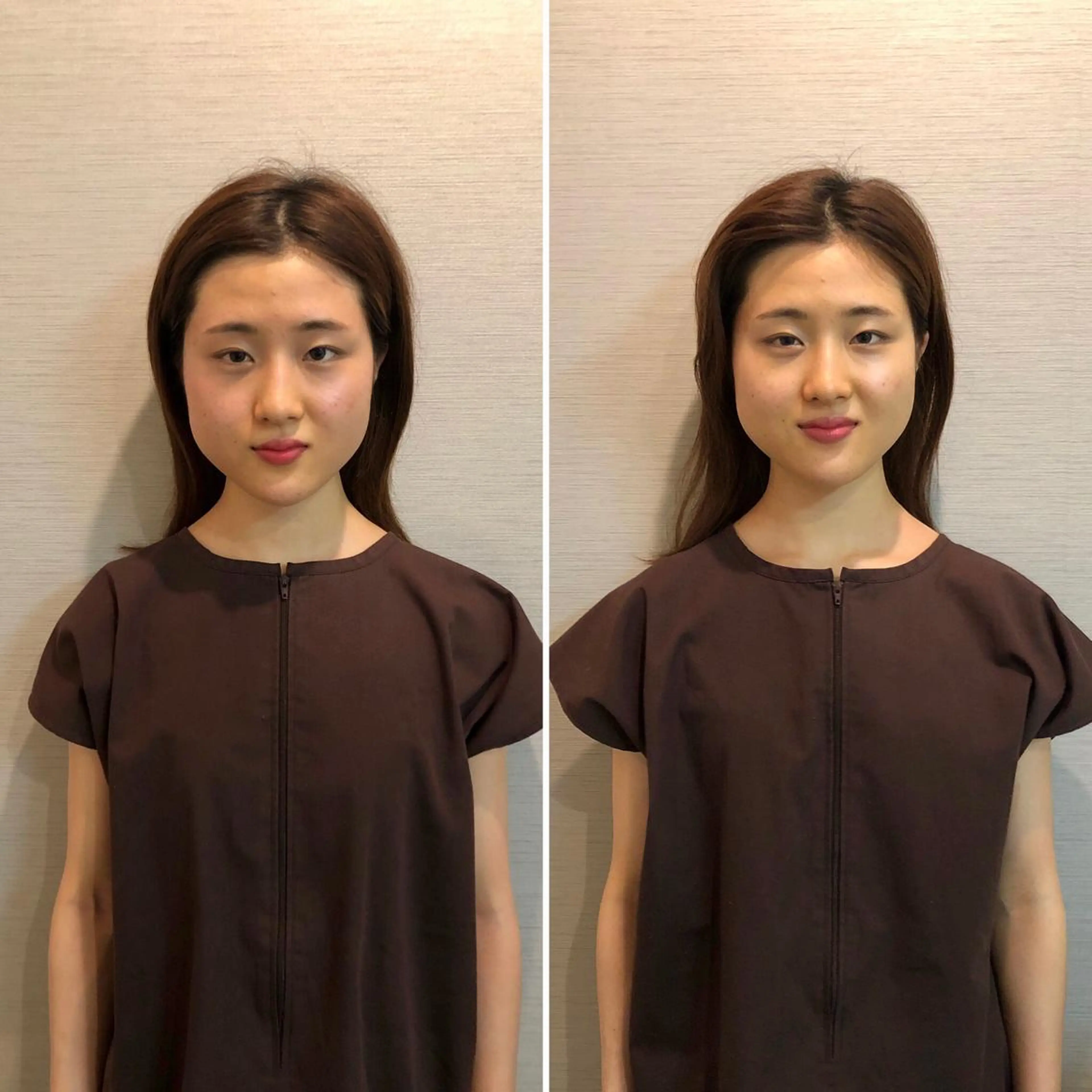 その他 即小顔♥️美容鍼× ハーブピーリングのその他イメージ