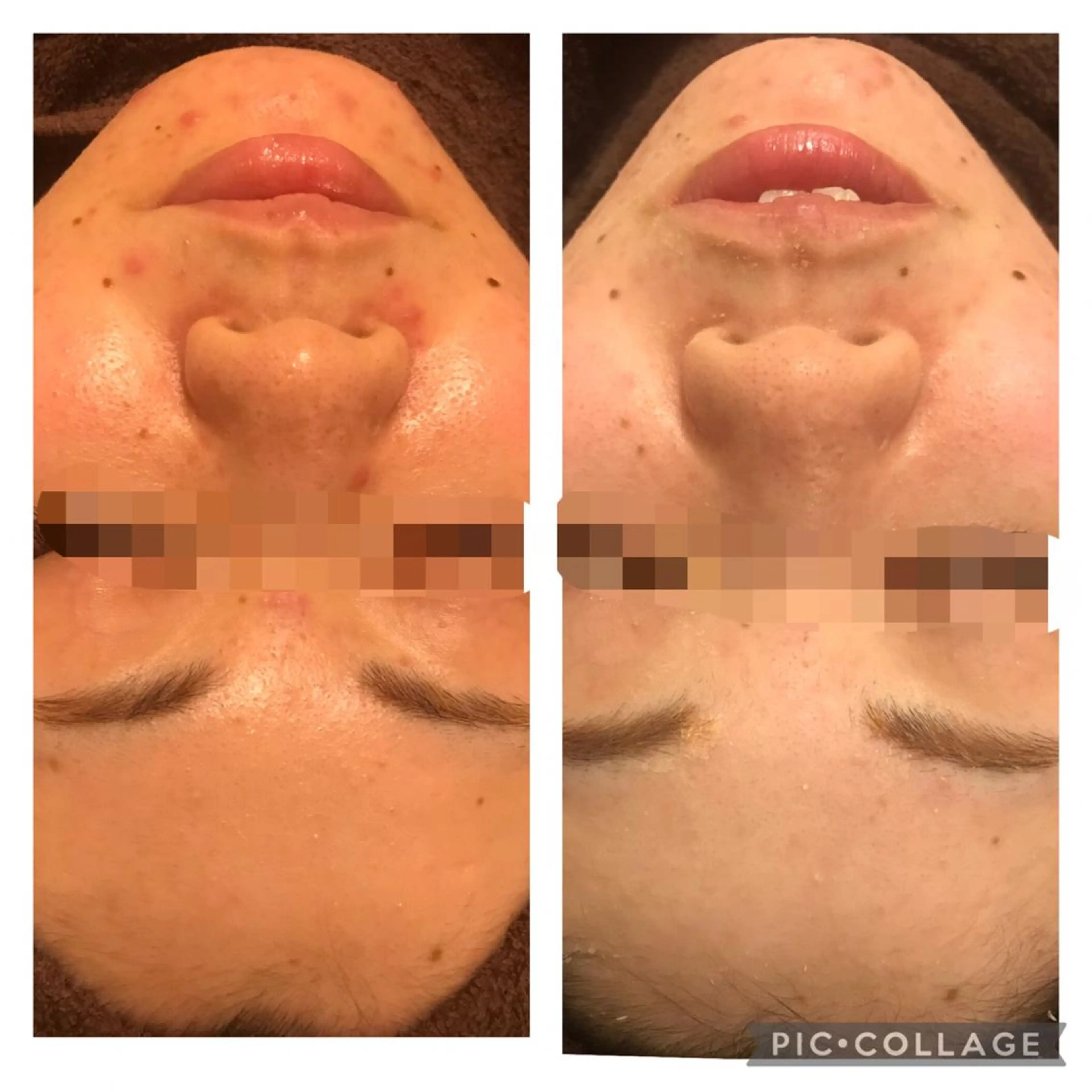 ミディアム パーマ ヘアアレンジ メンズ キッズ ネイル マツエク・マツパ アイブロウ アニメ,Vオタク× 即効痩せエステサロンのエステ・リラクイメージ