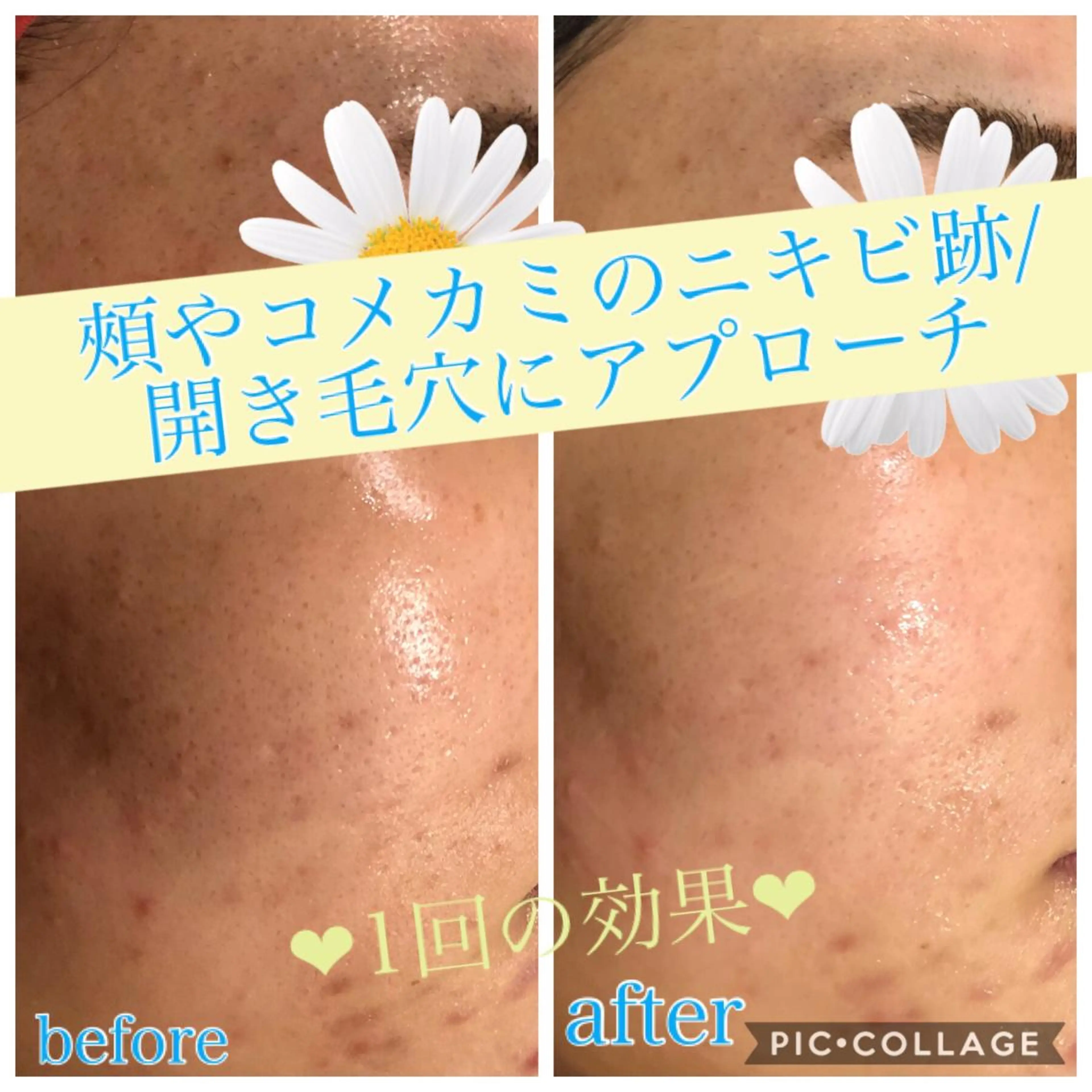 ショート カラー パーマ ヘアアレンジ キッズ ネイル マツエク・マツパ Ensor Clair所属・EnsorClair 代表 野口真央のエステ・リラクイメージ