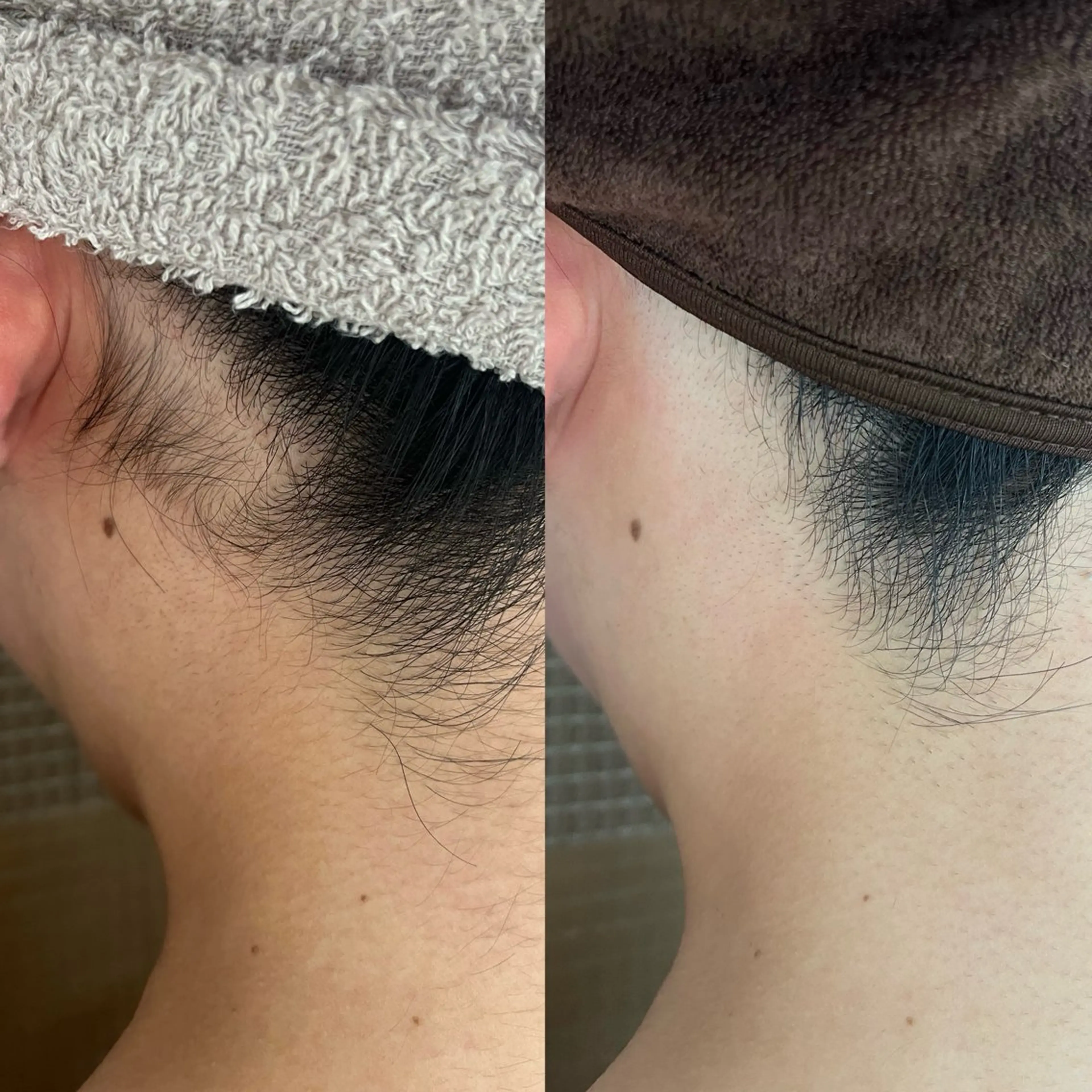 脱毛 エステサロンTug高知駅前店所属・Tug 高知駅前店/ NANAMIのその他イメージ