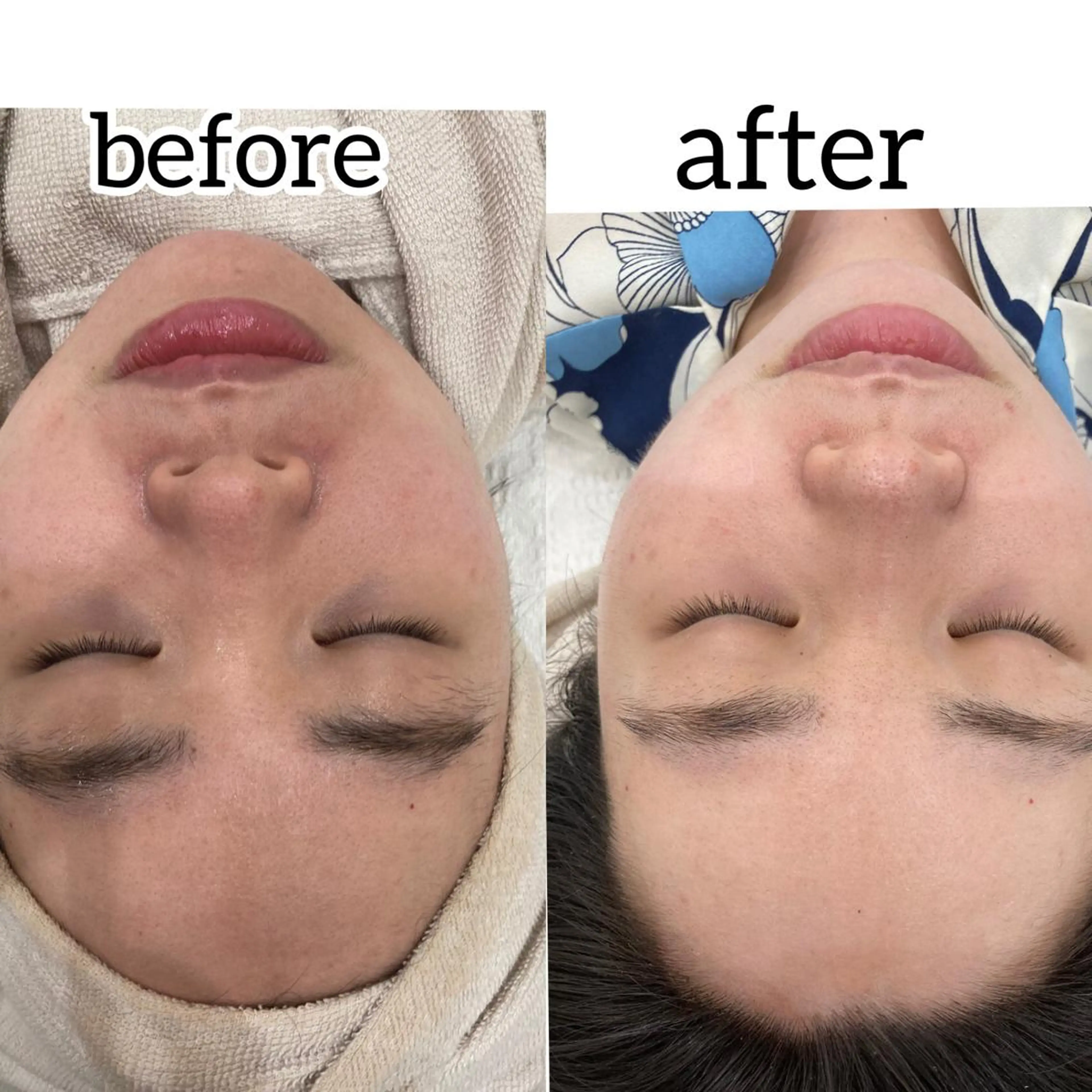 laluna saki...のその他イメージ