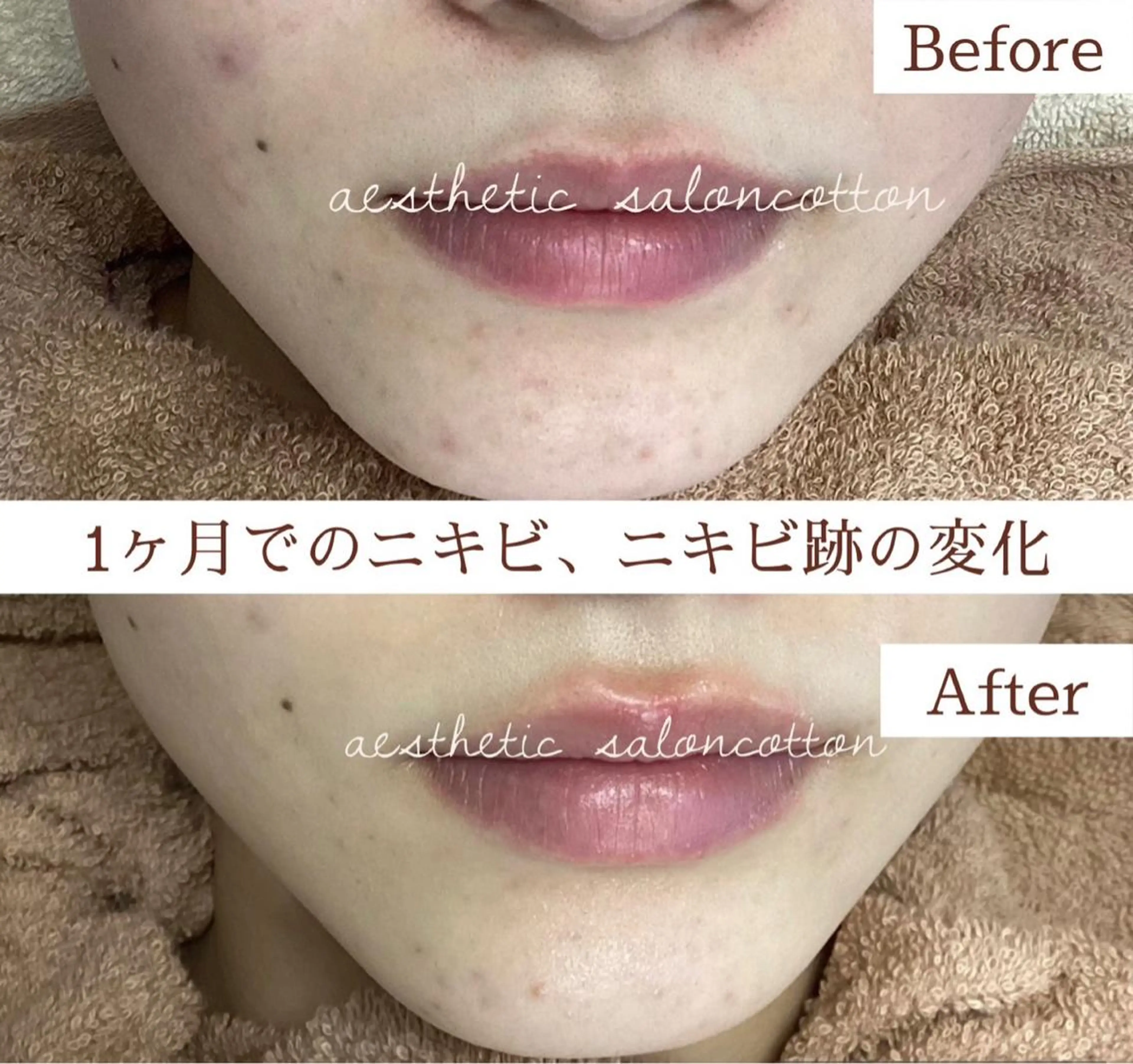 エステ 都度払い 肌質改善専門サロンのエステ・リラクイメージ