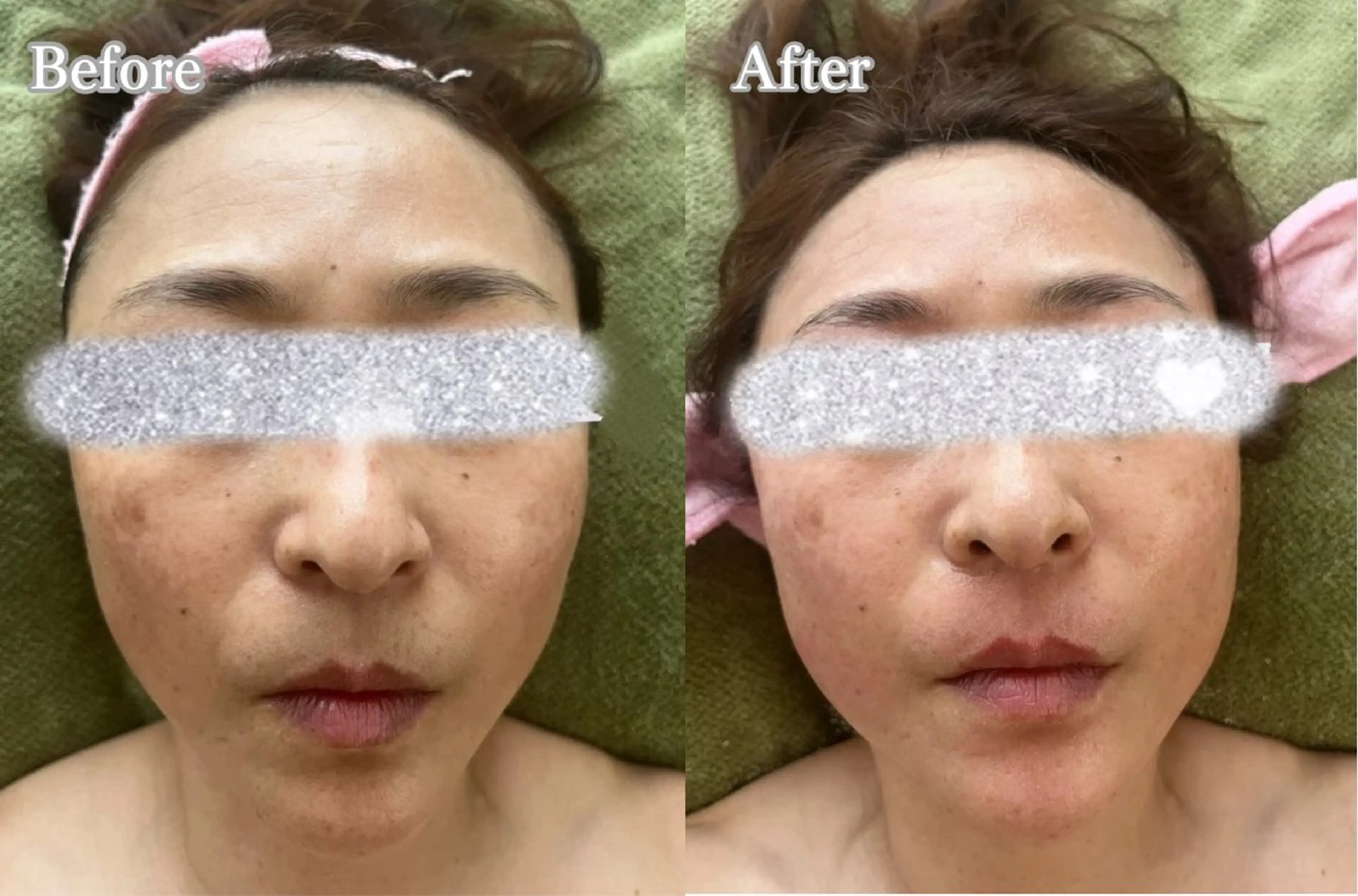 facial salon D 吉沢のエステ・リラクイメージ