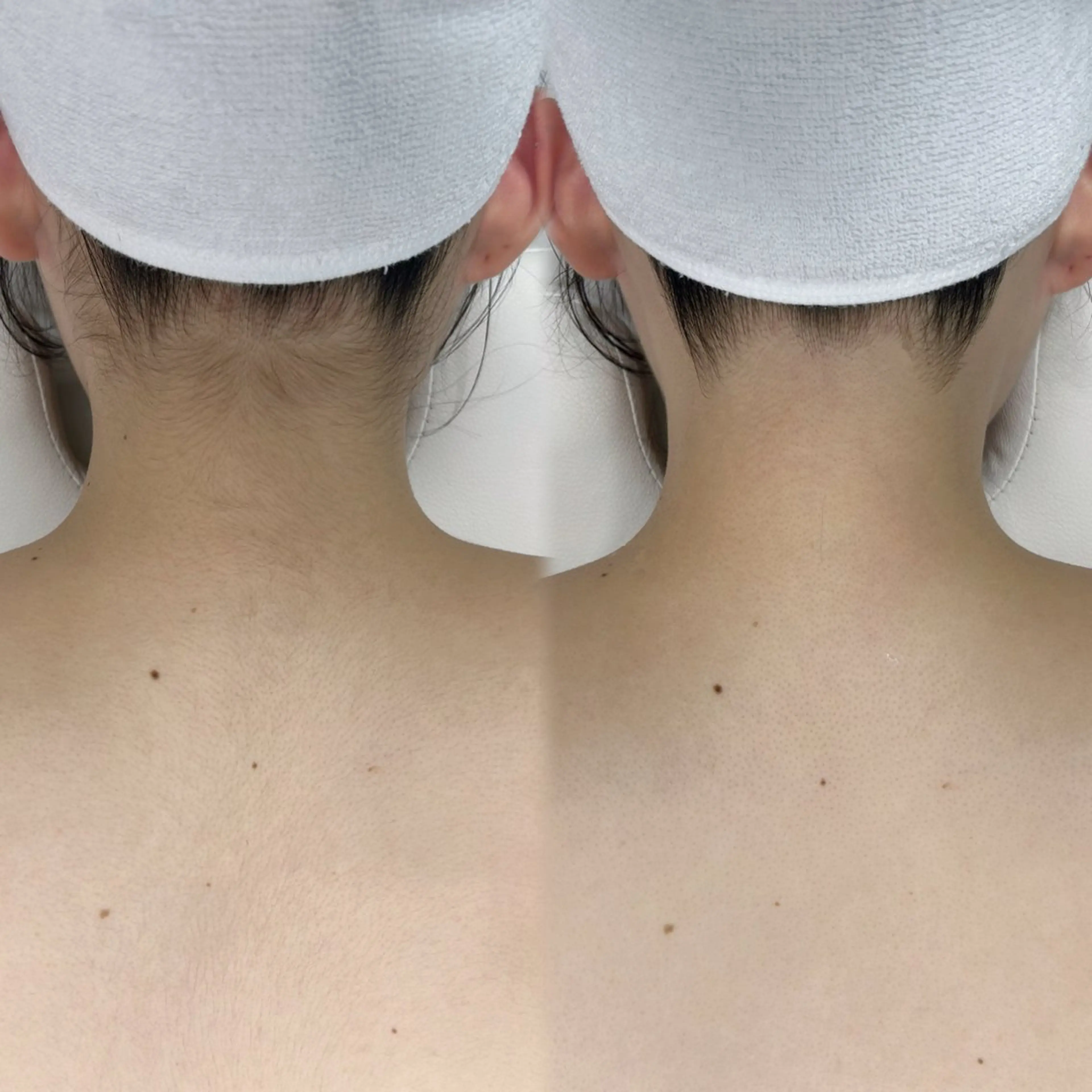 脱毛 かんな🤍 眉毛/脱毛の眉毛・アイブロウイメージ