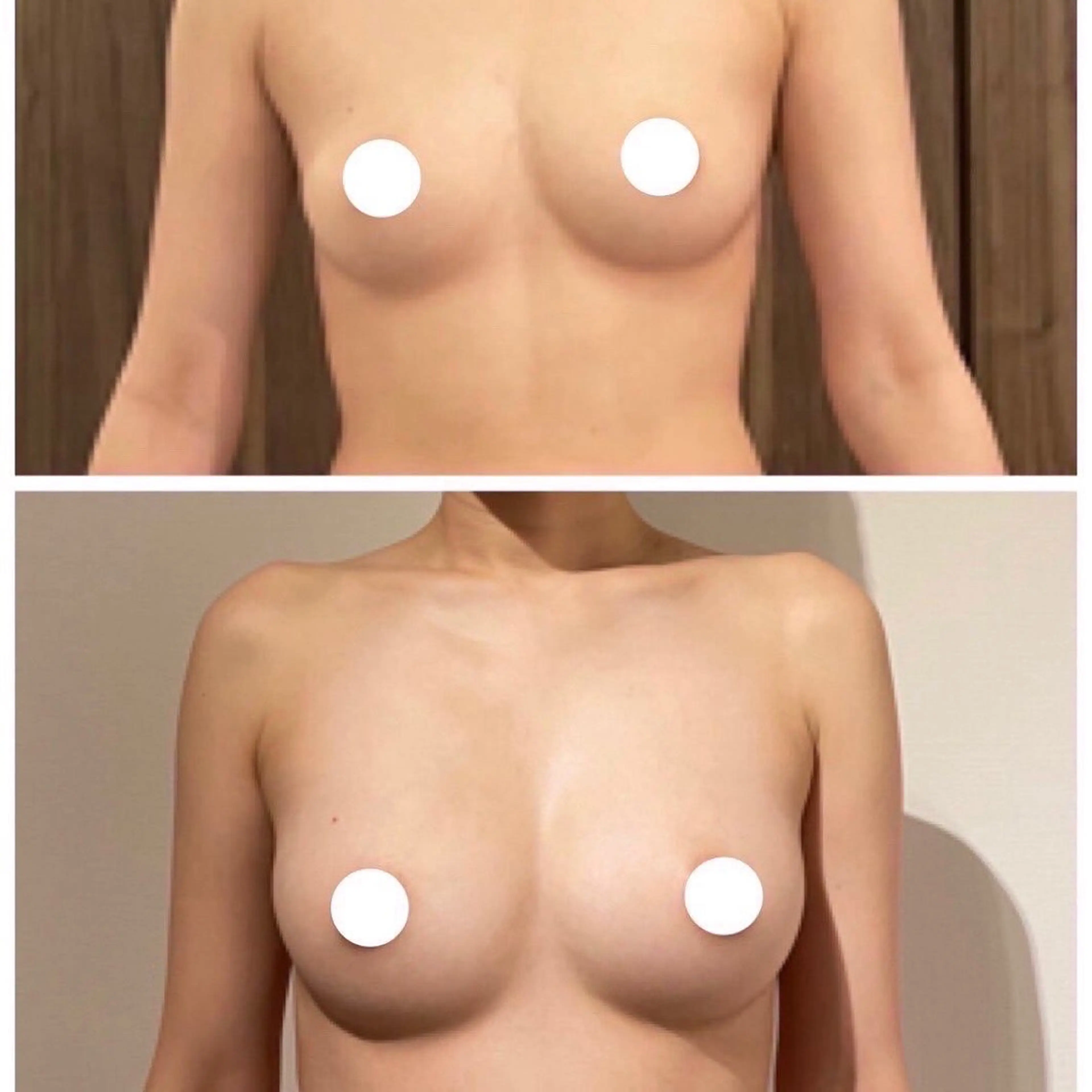 【人気No.1】小胸悩みさん専用◎2カップUPを目指すバストアップ上半身体験(施術45分)33000→9900の写真