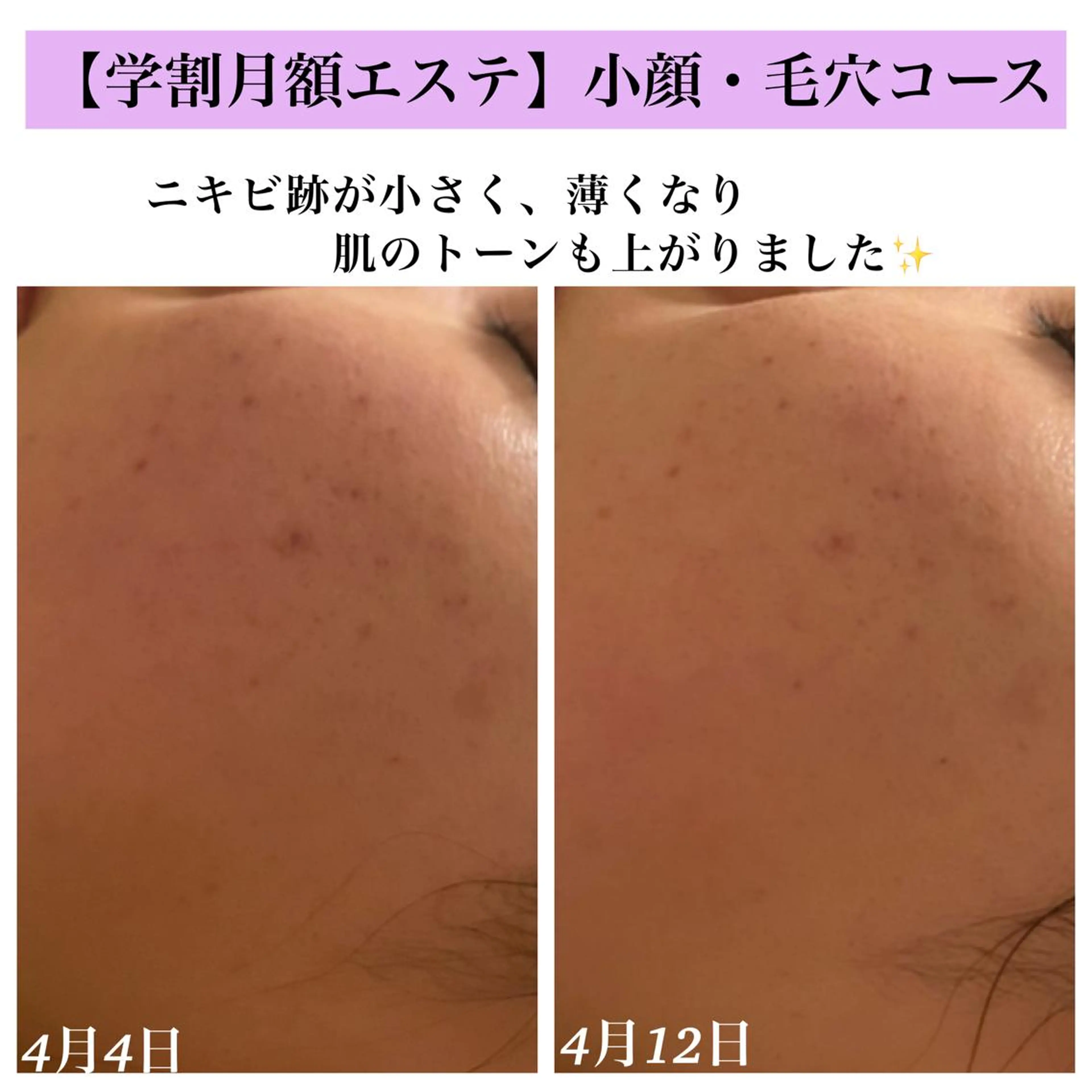 Bellesthe (ベルエステ)のエステ・リラクイメージ