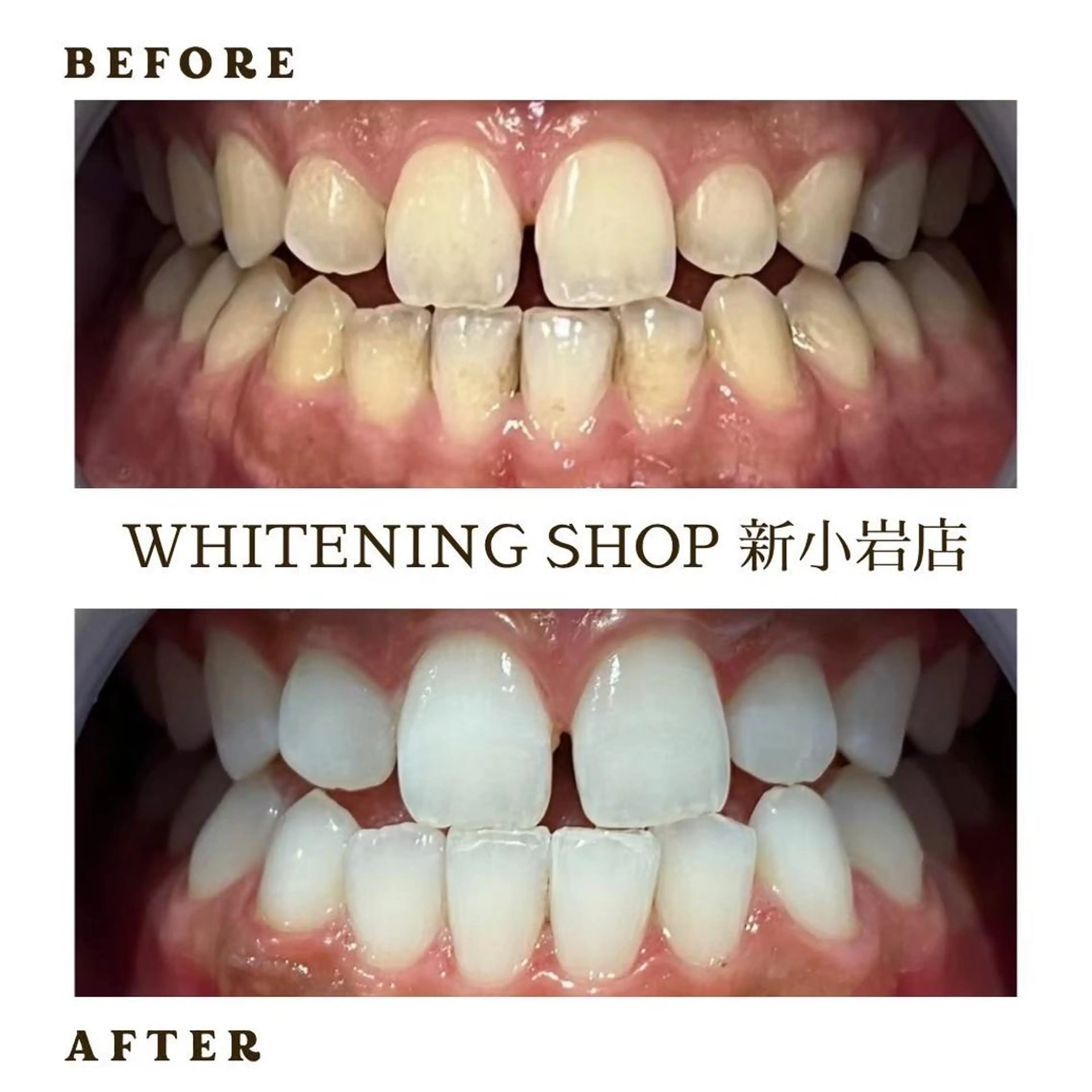 メンズ その他 ホワイトニング ショップ新小岩店のその他イメージ