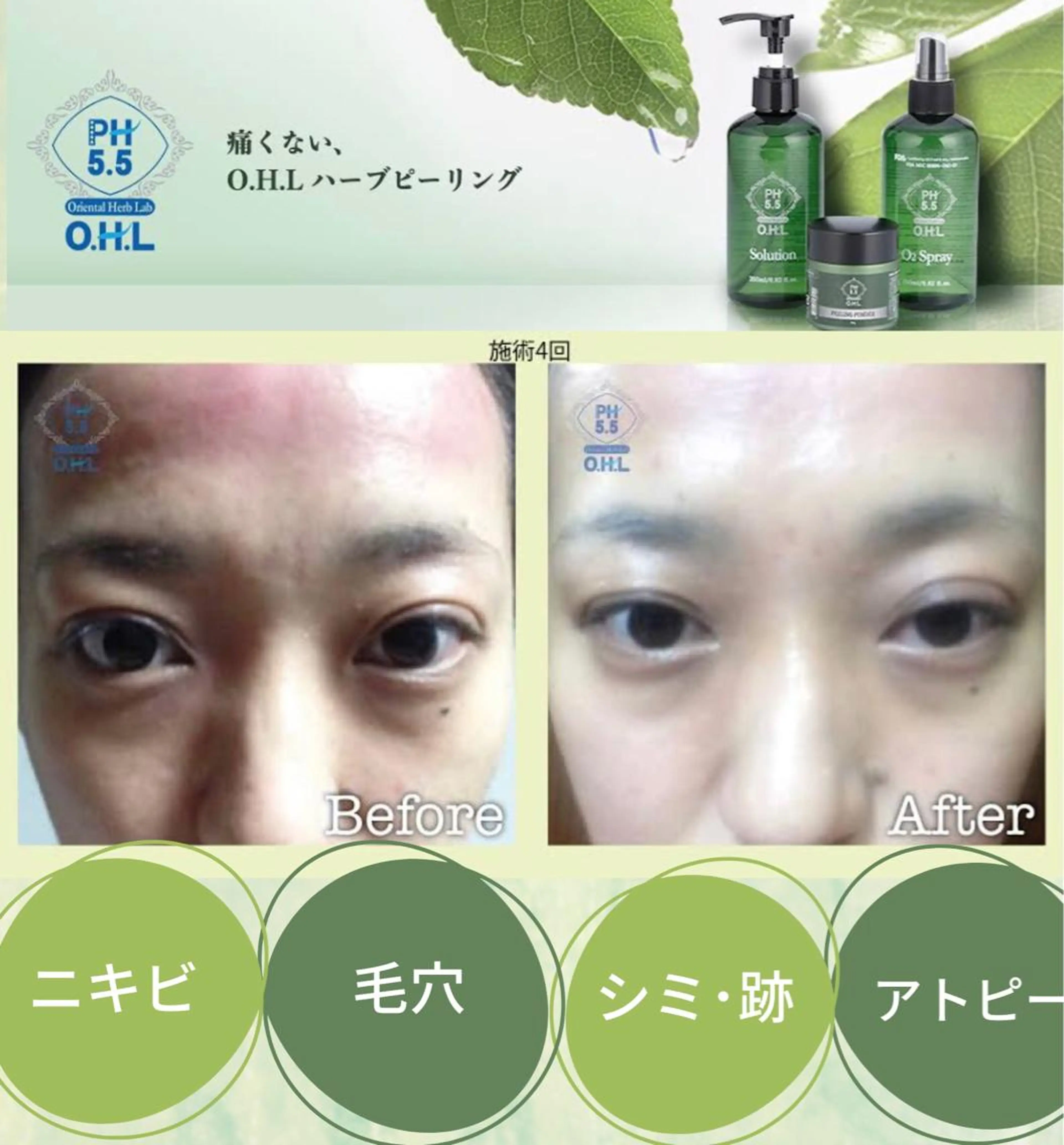 エステサロン JURISのエステ・リラクイメージ