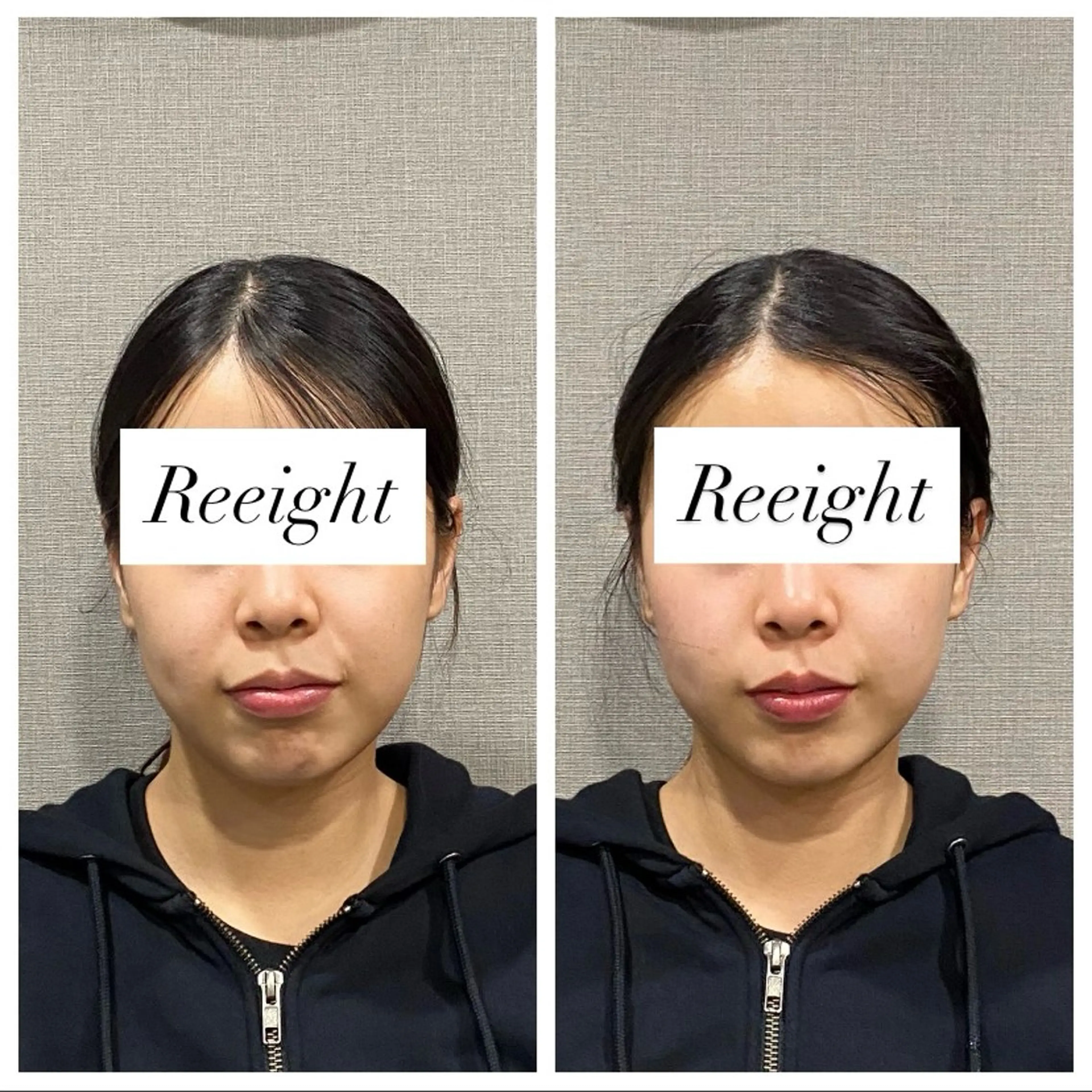 エステ 肌質改善専門 ハーブ /毛穴洗浄 リエイトのエステ・リラクイメージ