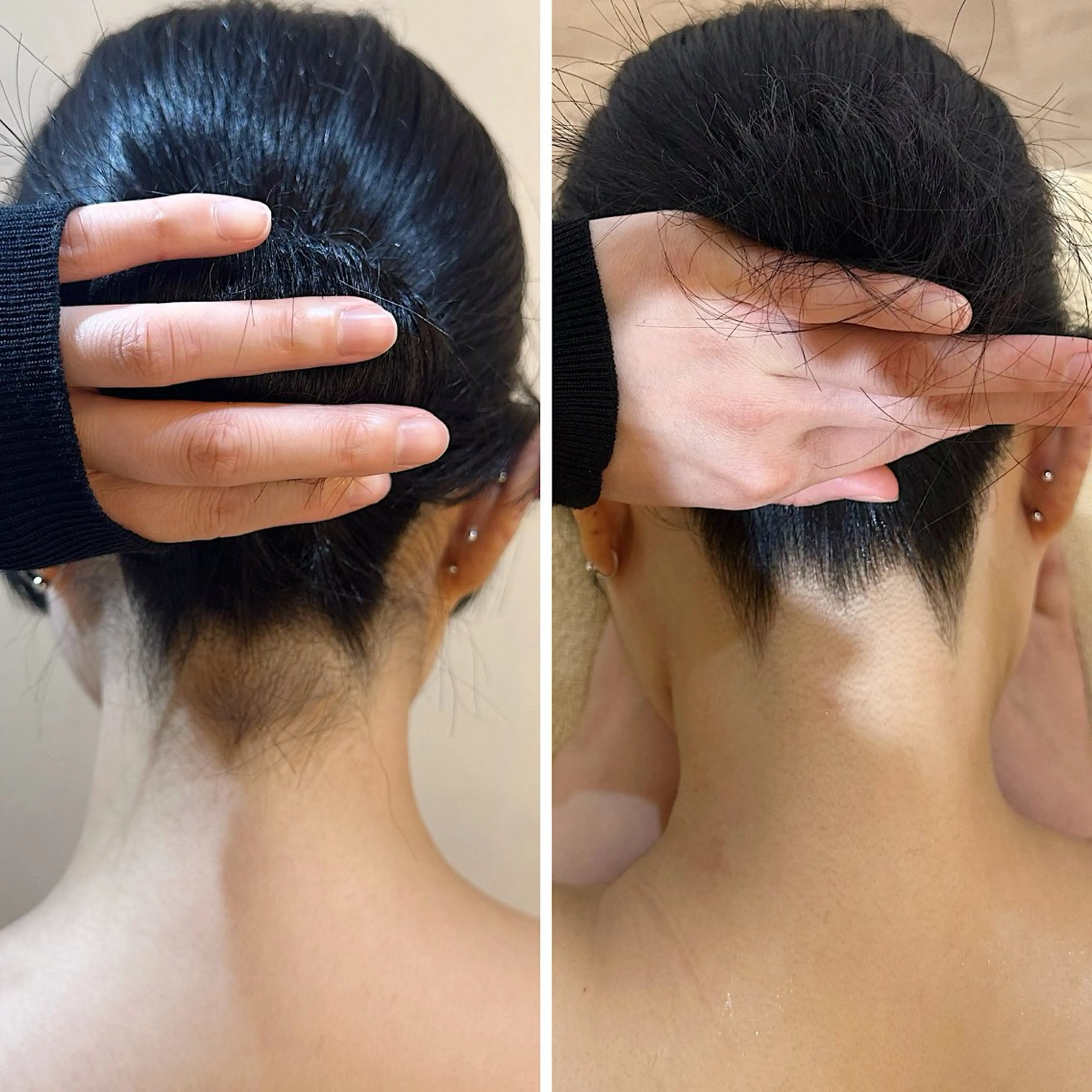 脱毛 うなじ脱毛/美肌脱毛 LABELのエステ・リラクイメージ