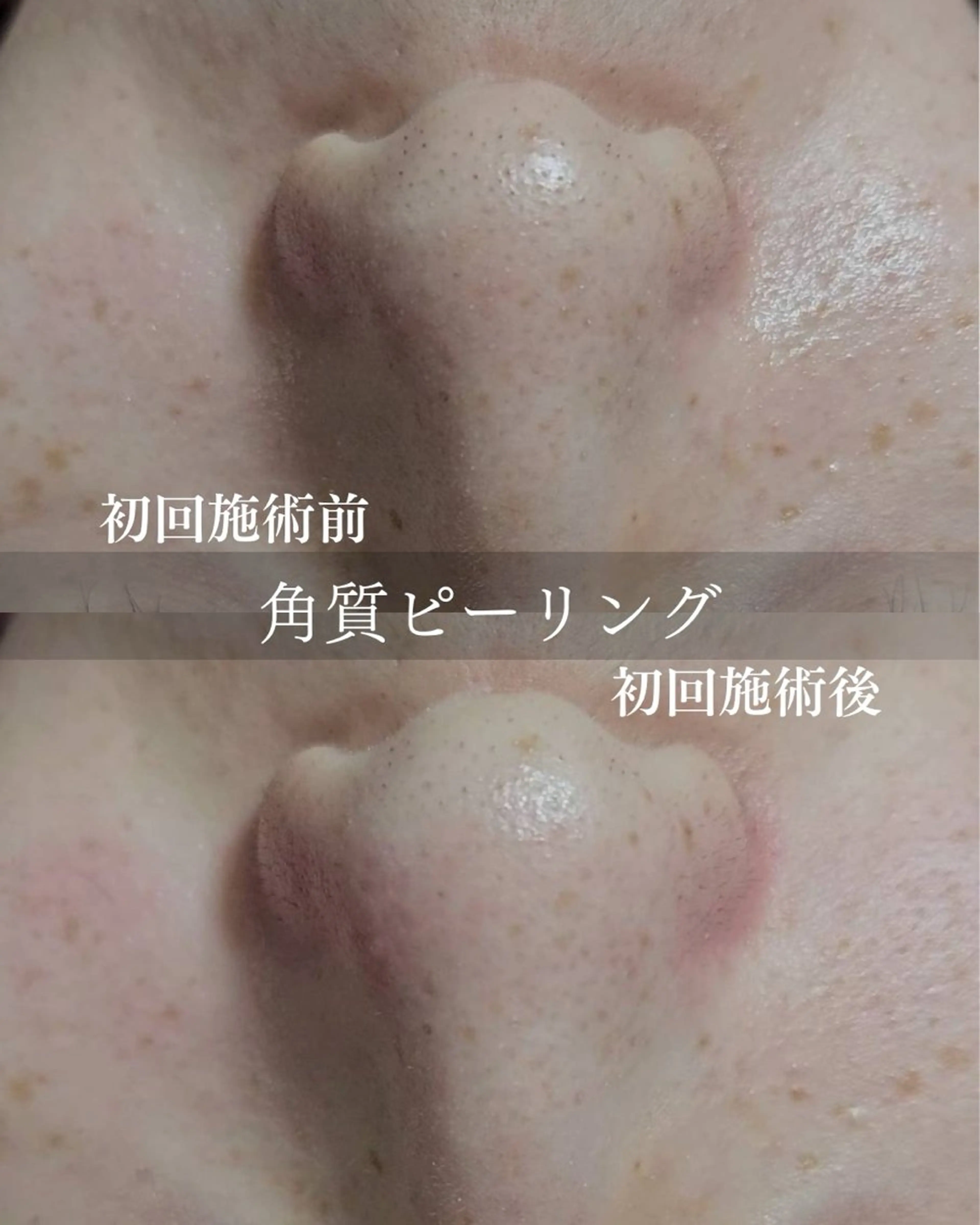 ESPOIR 鈴木七海のエステ・リラクイメージ